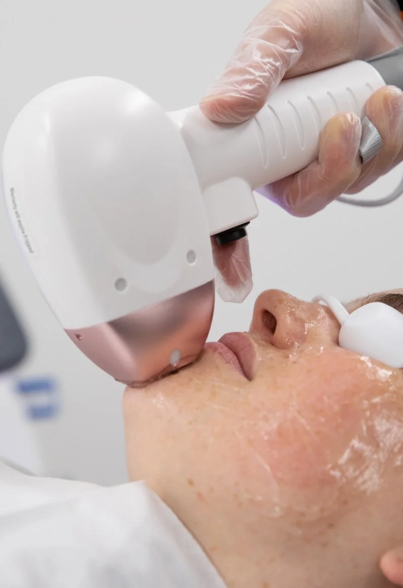 Where to find safe, permanent laser hair removal with advanced technology suitable for all skin types?