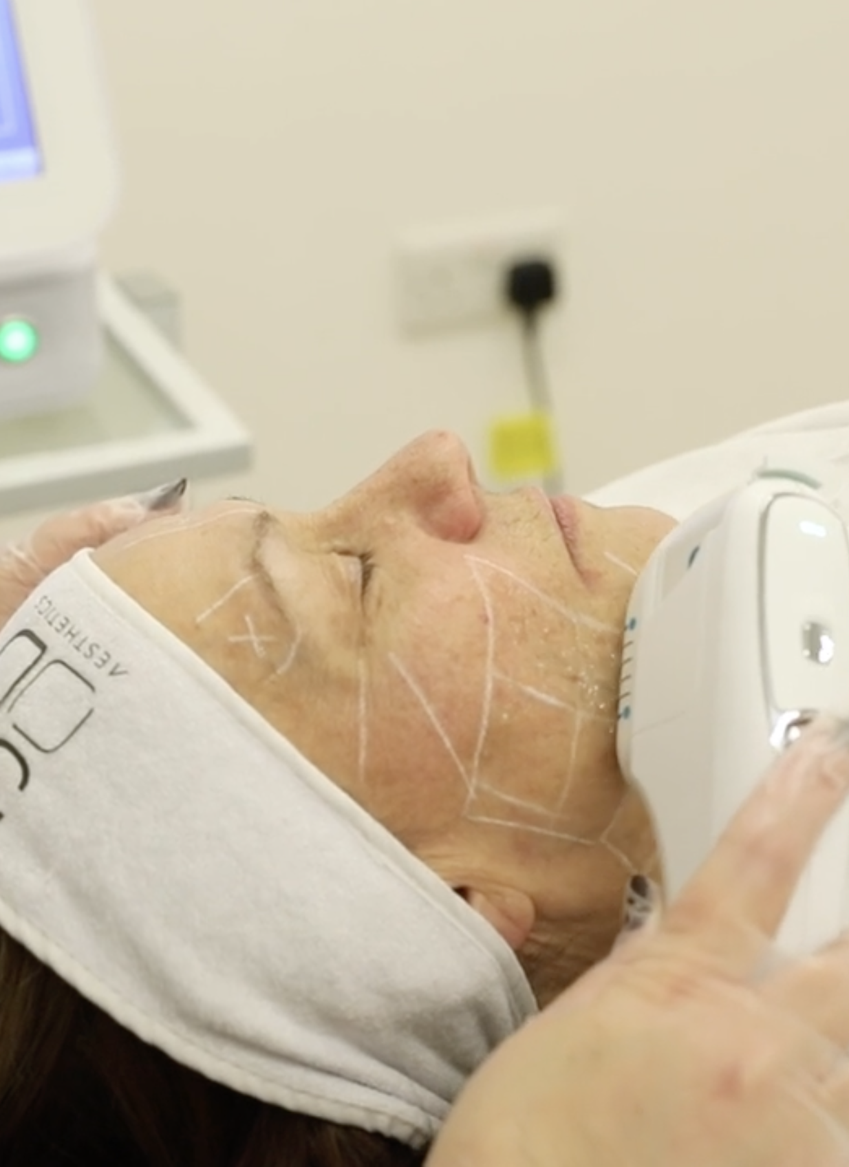 What is 3D HIFU? It is an advanced ultrasound based treatments