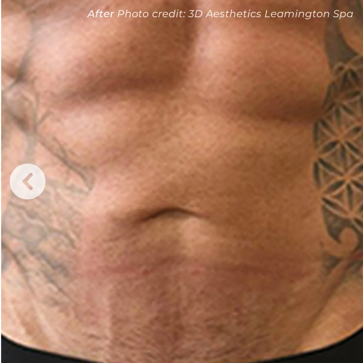 Close-up of a person's face showing their nose, lips, and part of a tattoo on their cheek and jawline.