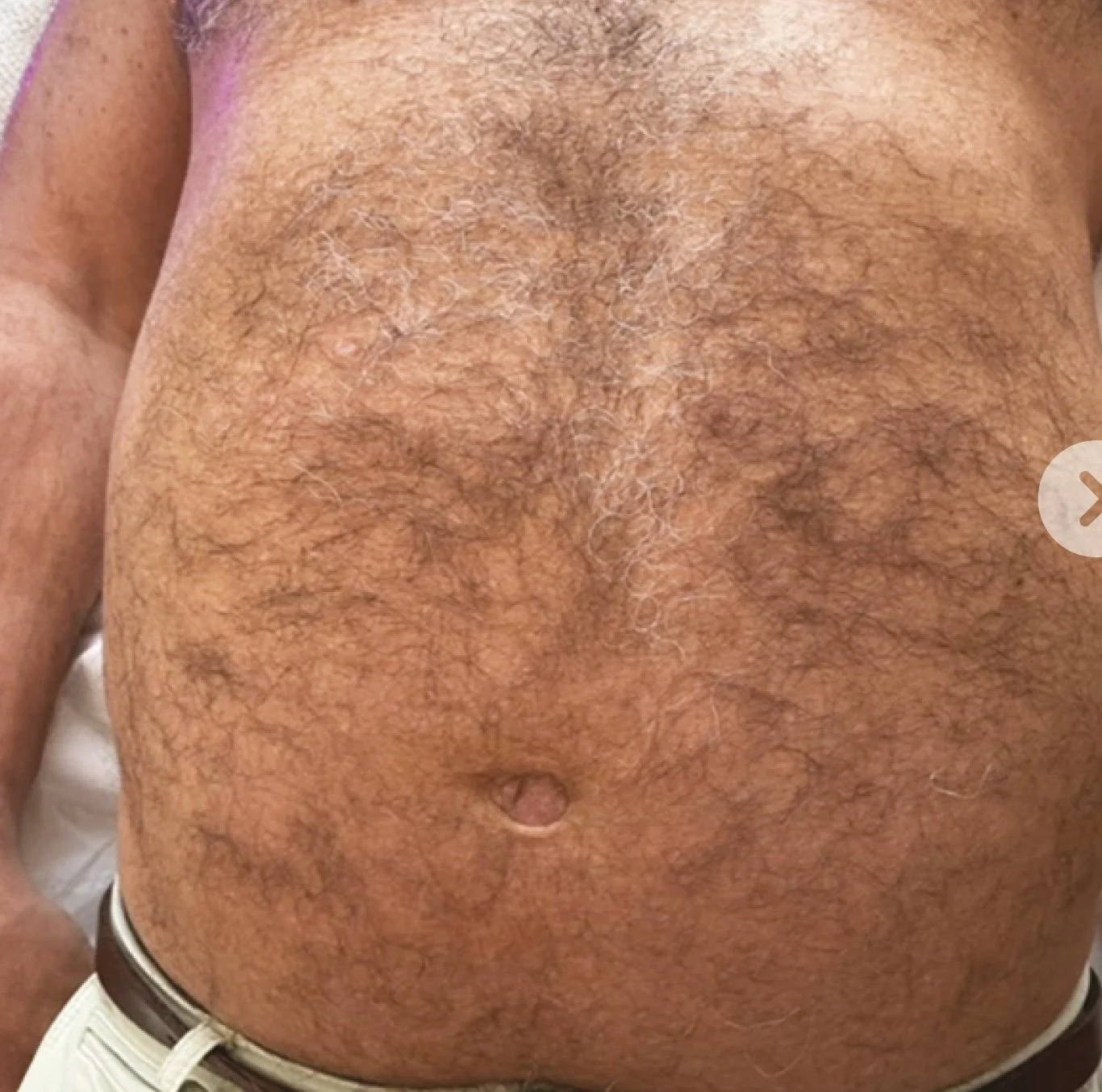 Close-up of a man's hairy, tanned abdomen and chest, with visible pores and skin texture.