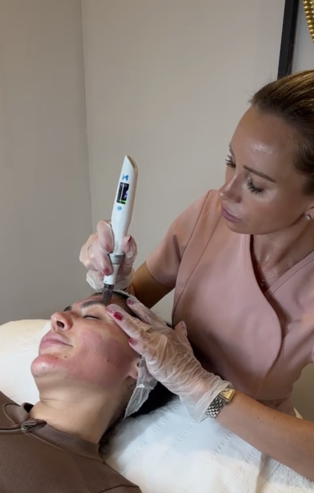 A woman receiving a cosmetic treatment with a handheld device on her forehead while lying down, with a professional using gloves.