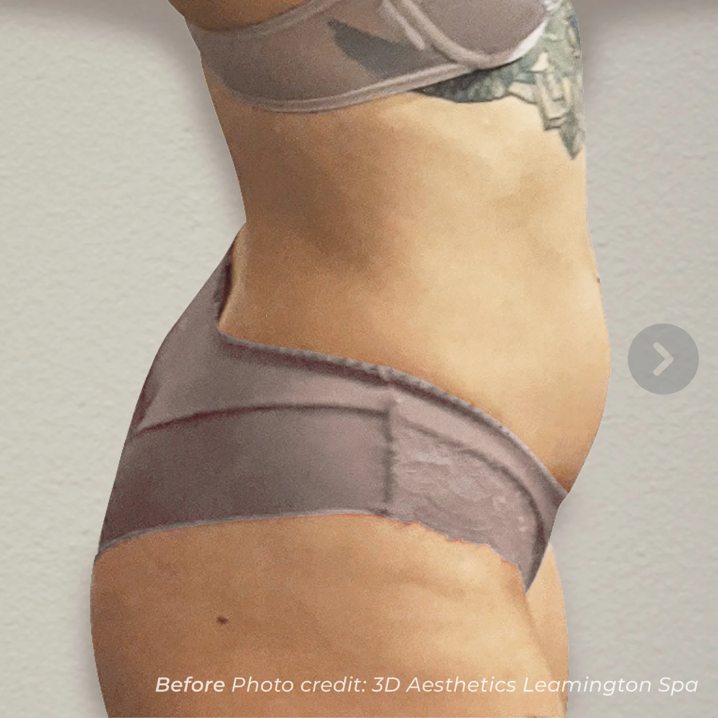 Close-up of a woman's side profile showing her midsection, wearing a beige bra and matching underwear, with a tattoo partially visible on her upper chest and shoulder.