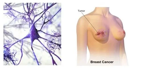 Breast cancer prevention illustration