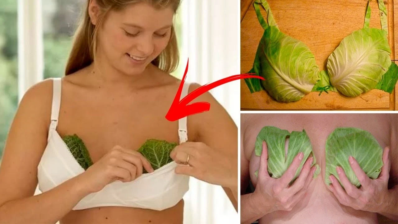 Chilled cabbage leaves sometimes used for comfort during lactation suppression