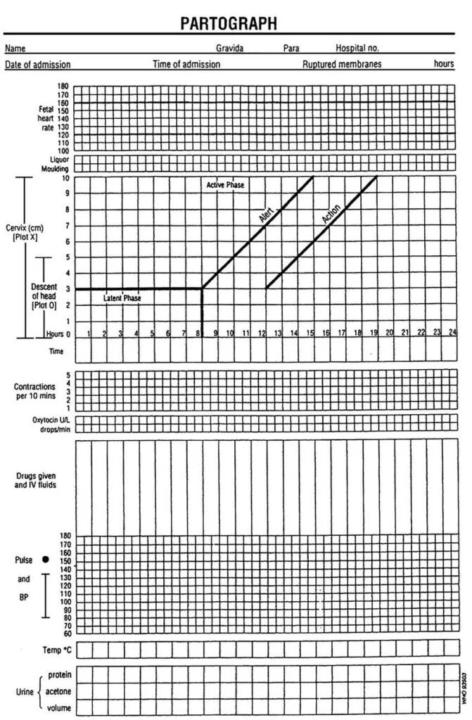 partograph-671x1024.jpg