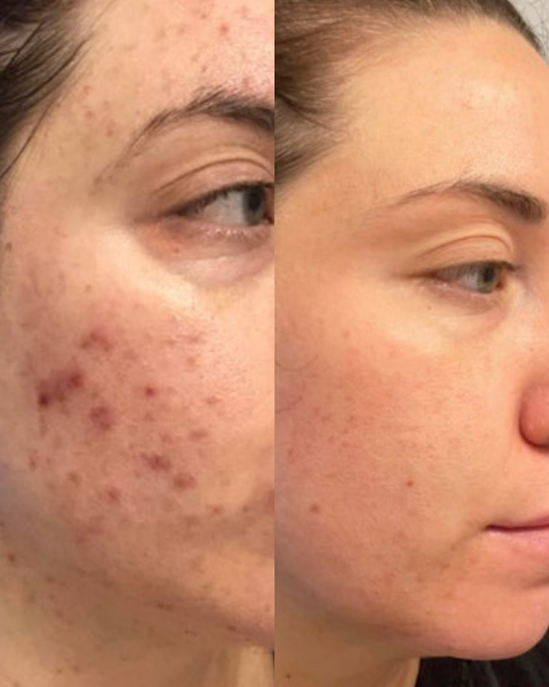 Untitled design 3.PNG