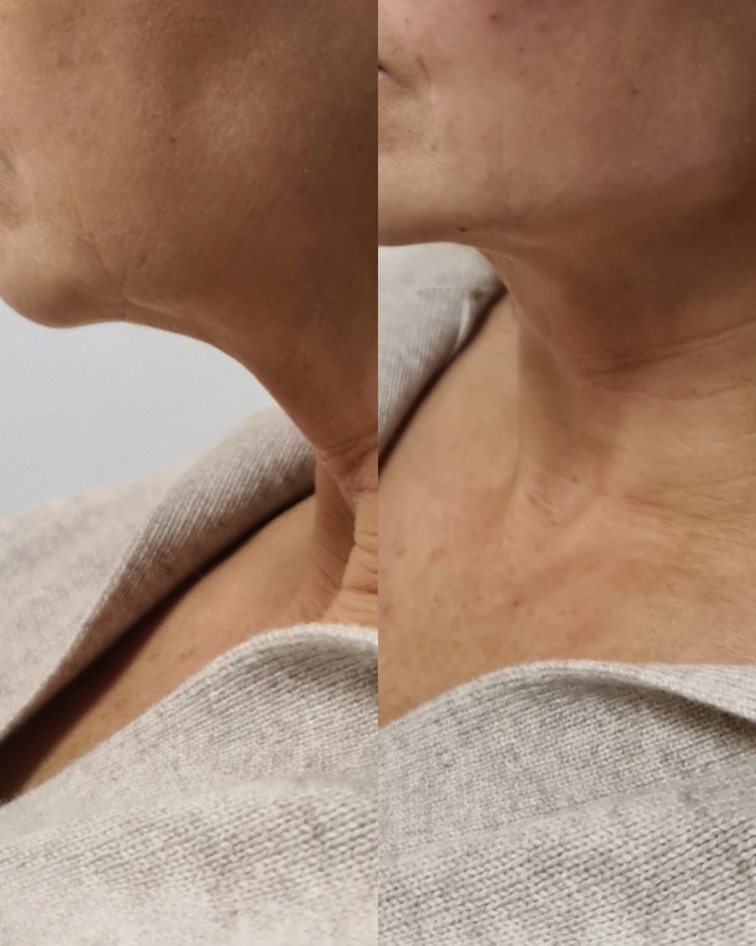 Untitled design 5.PNG