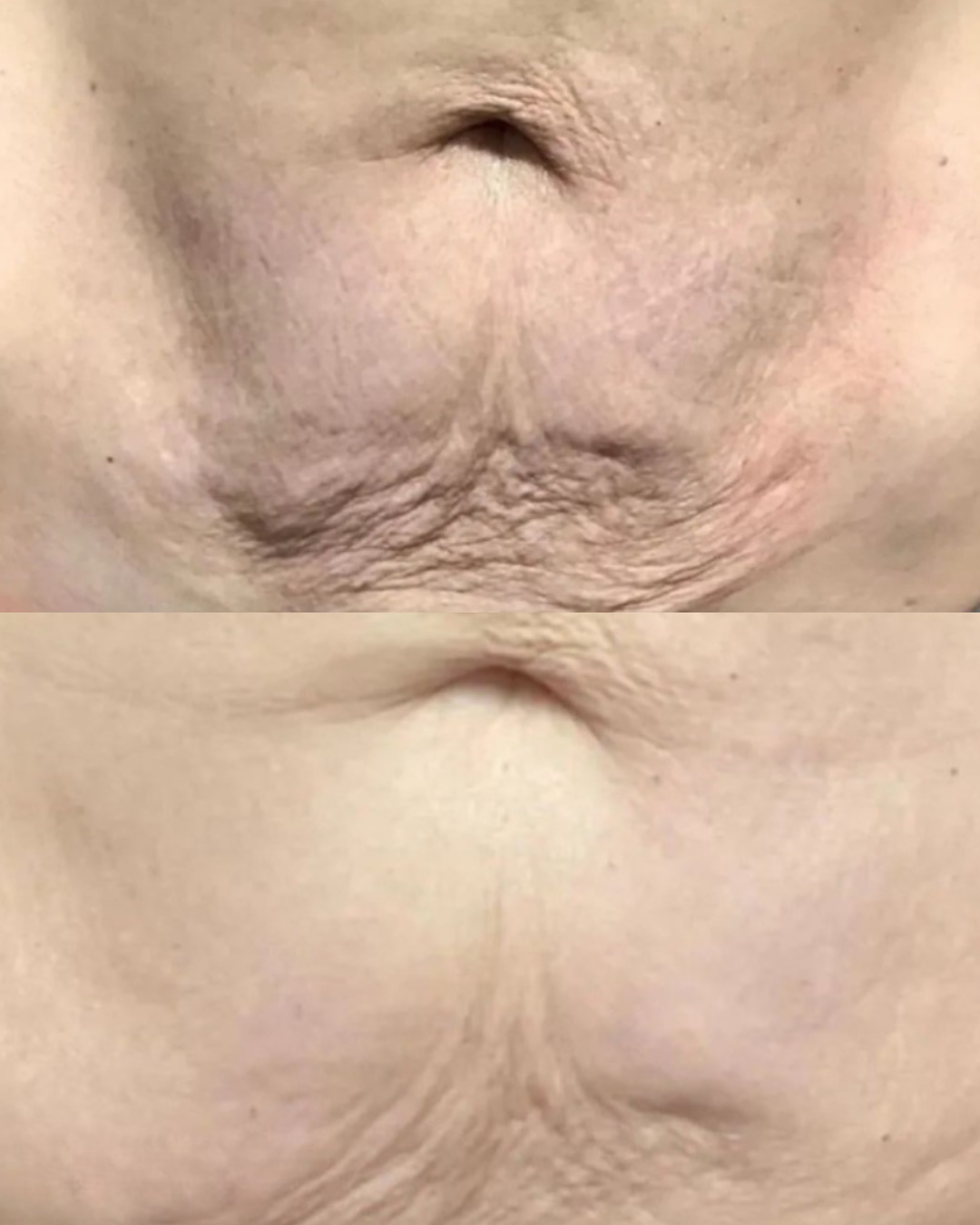 Untitled design 4.PNG