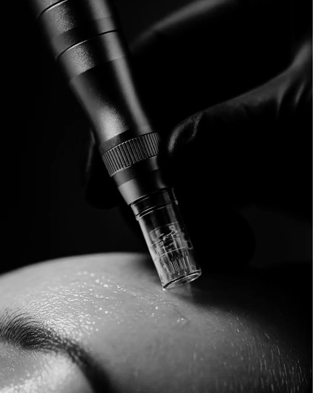 Ll&eacute;vate un 2x1 en &aacute;cido hialur&oacute;nico + microneedling
 o ven con alguien y ambos pagan la mitad.

Resultados visibles, piel m&aacute;s hidratada, uniforme y luminosa desde las primeras sesiones.

Agenda hoy. Estas promos no se repi