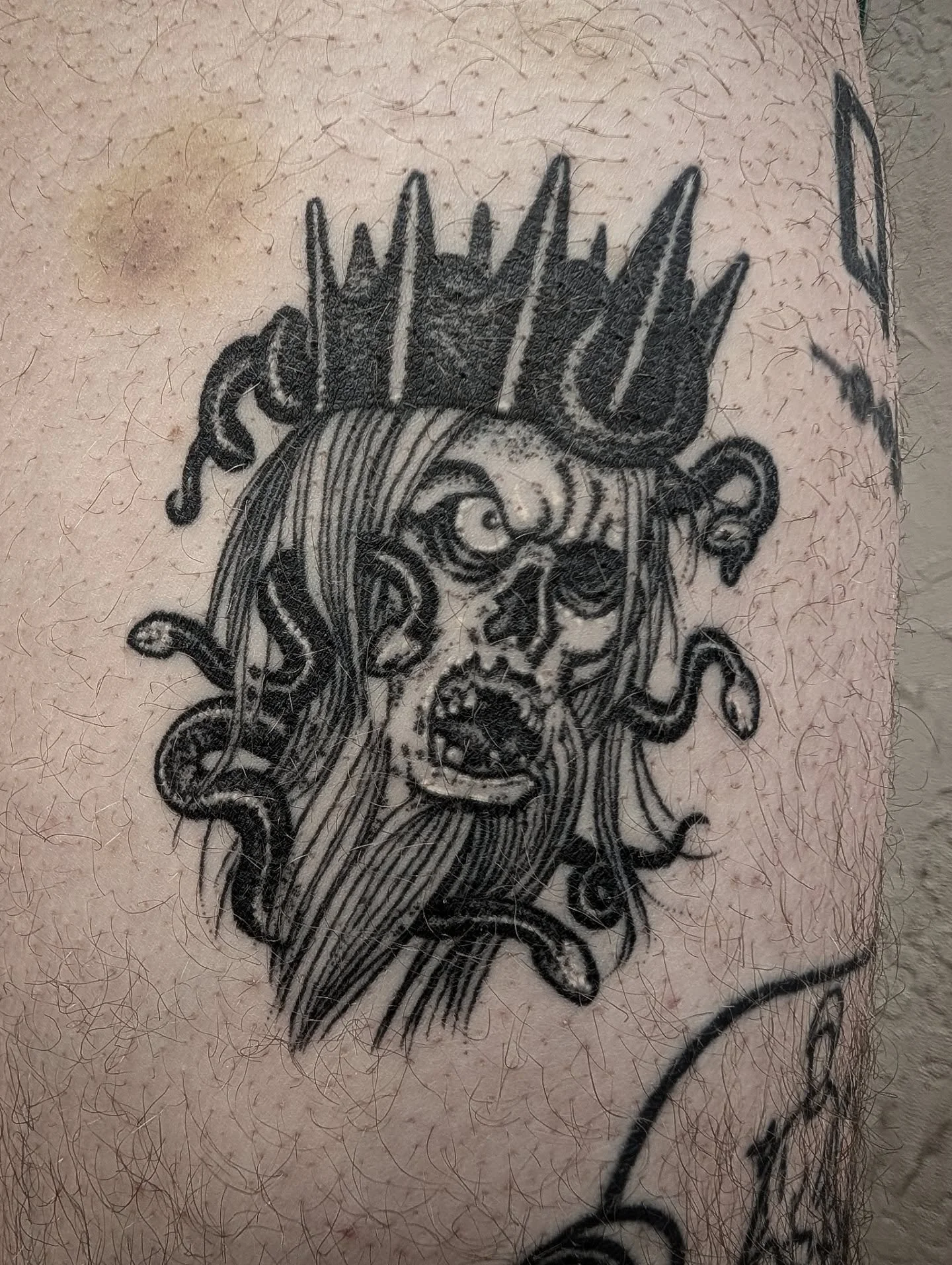Healed up on Nate. Thanks dog