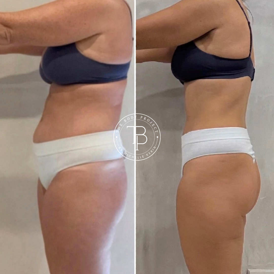 Untitled design (4).png