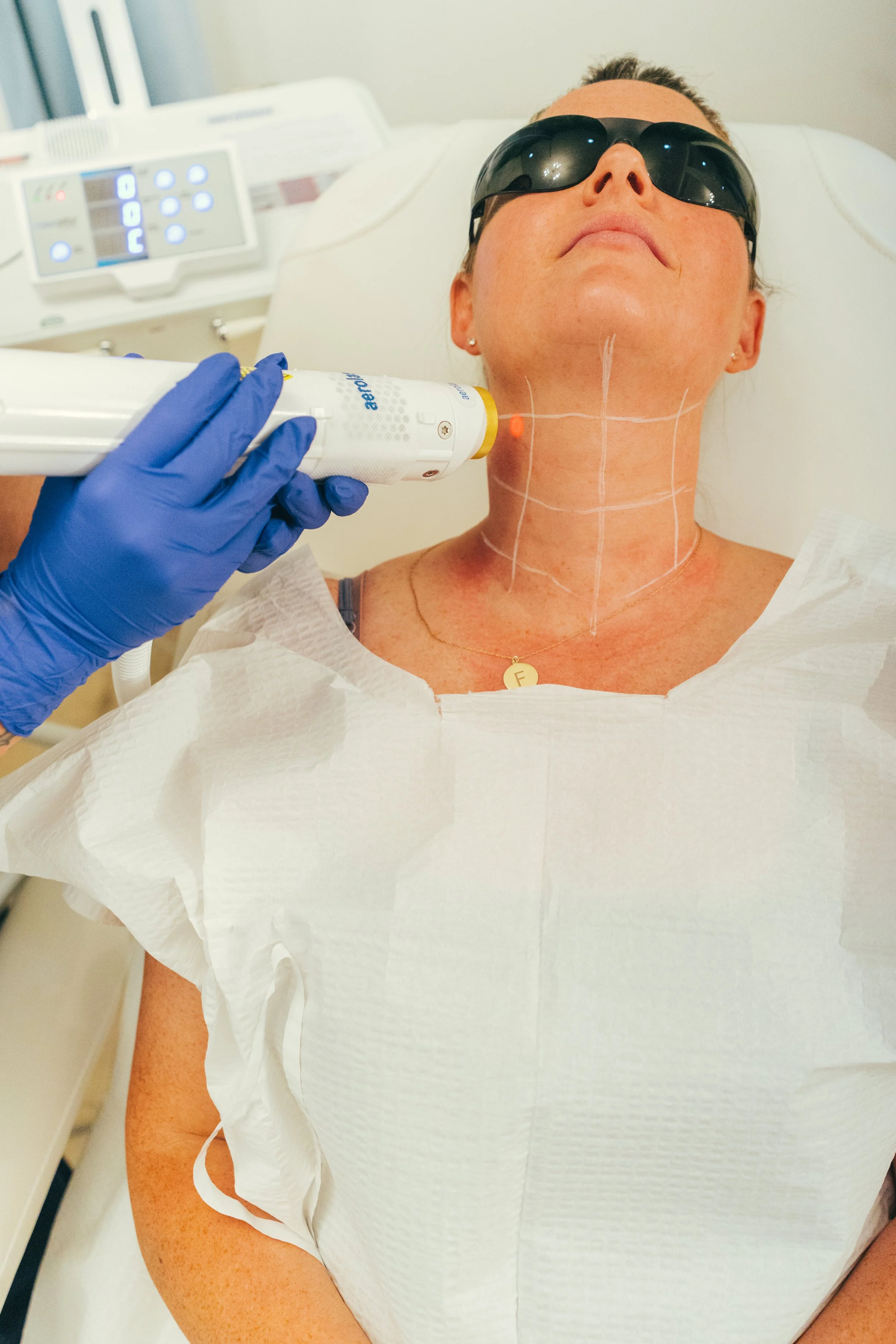Aerolase Laser Treatment in Slidell, LA
