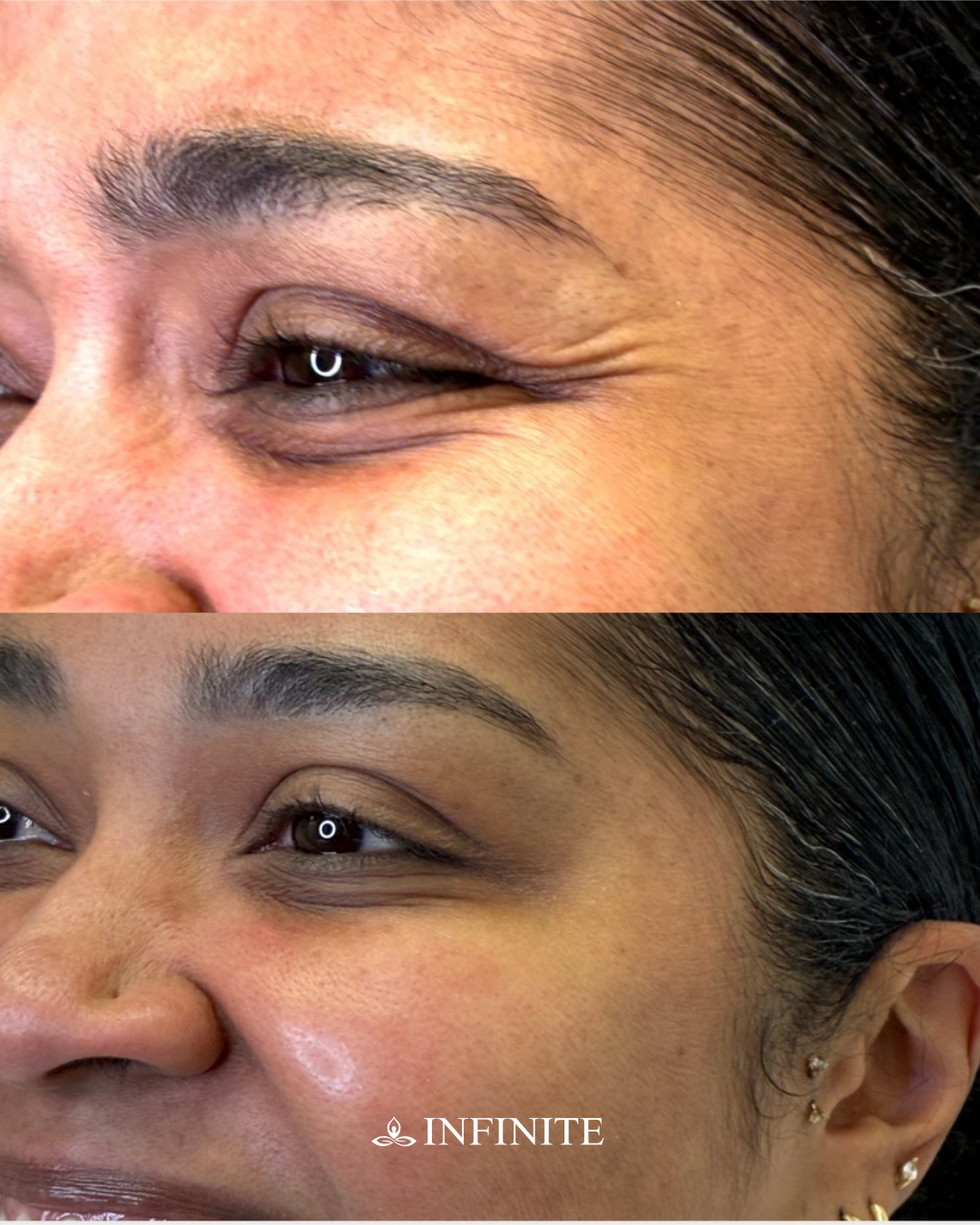 IMS B&A Side by Side 45 Carousel (12).png