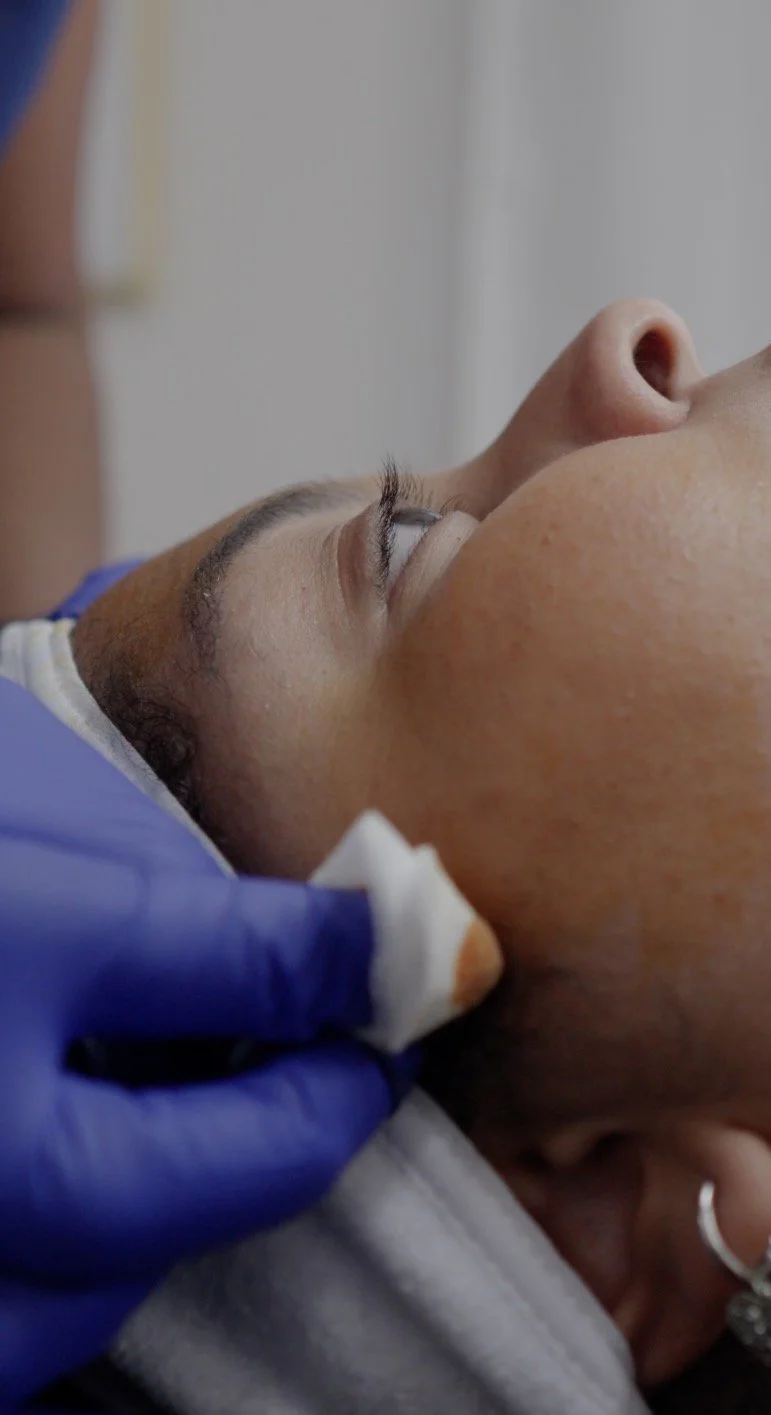 Chemical Peels in Slidell, LA: What Actually Happens to Your Skin (And What to Expect After)