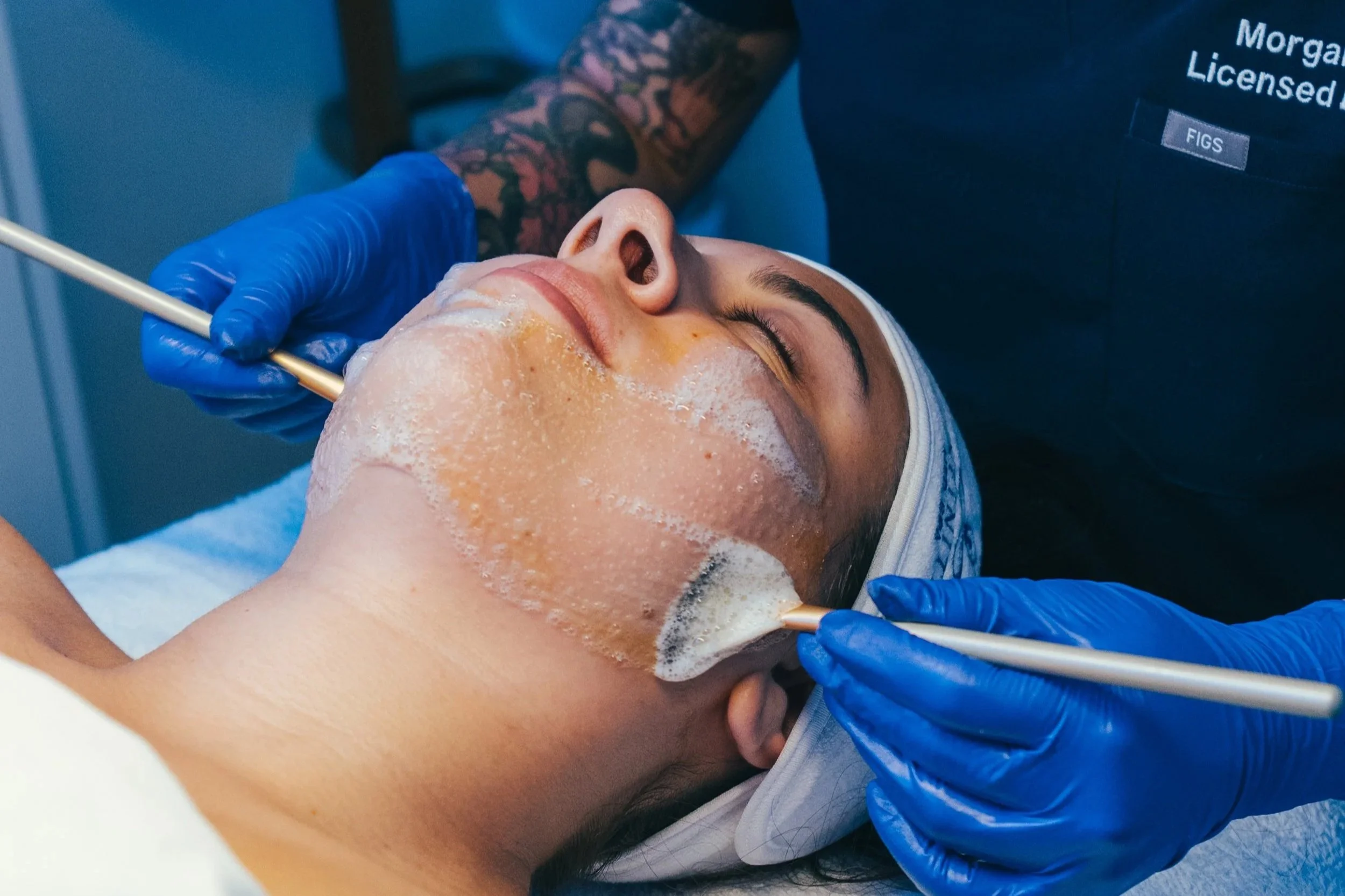 Client receiving a chemical peel treatment at Infinite Med Spa in Slidell, LA for brighter, smoother skin