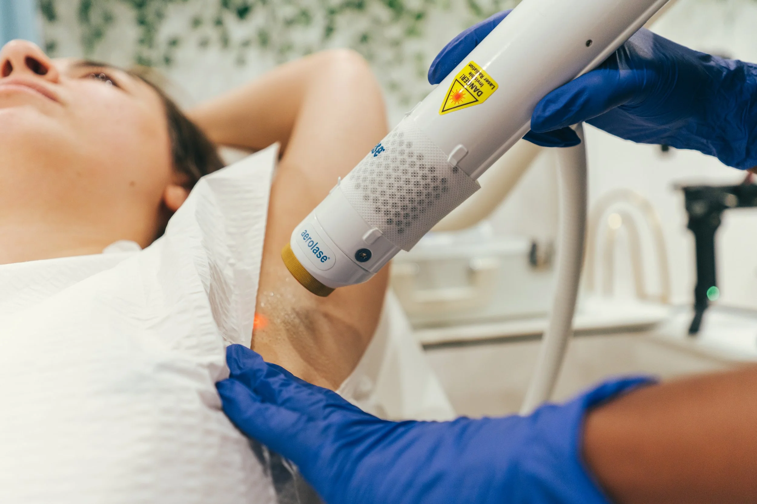 Patient receiving laser hair removal on their armpits