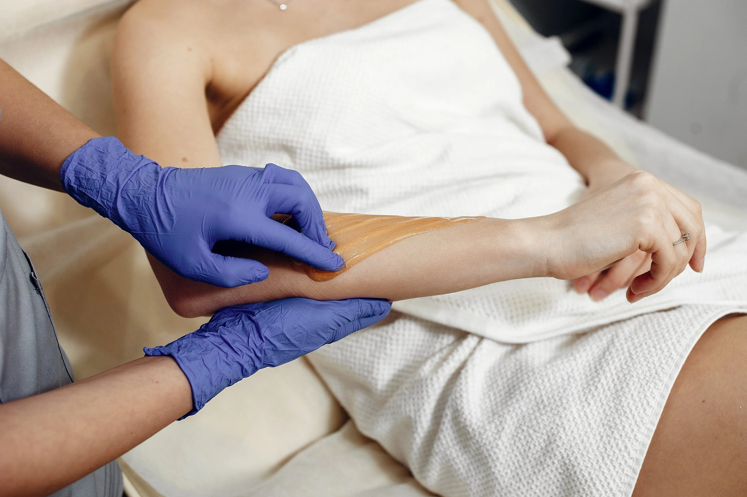 Professional applying wax to arm during hair removal treatment, using blue gloves