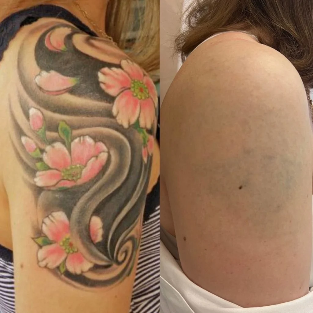 tatu-do-posle-1024x1024.jpg