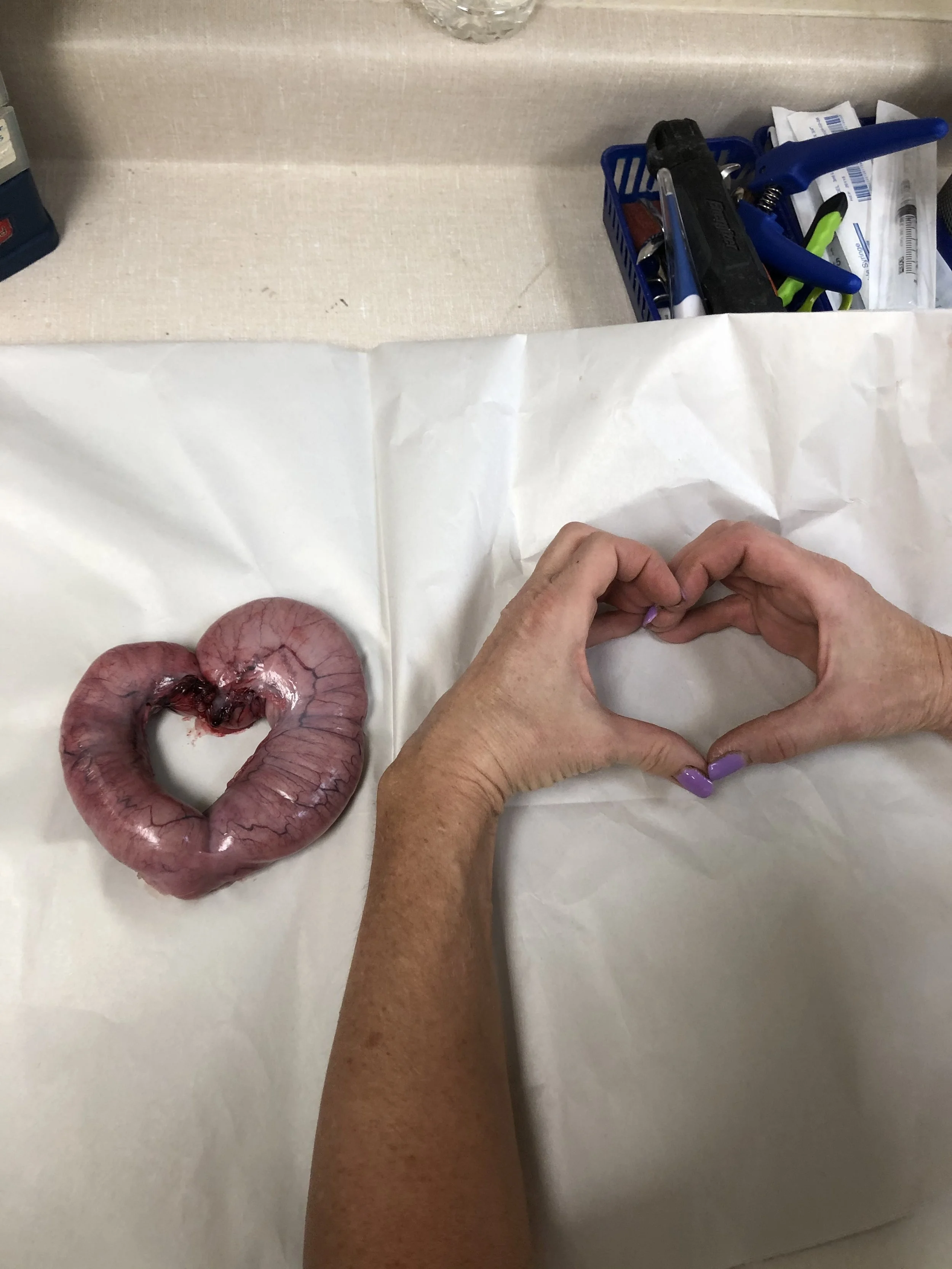 A person's hands with purple nail polish forming a heart shape, placed on a white sheet of paper. To the left, a raw, heart-shaped organ or meat is positioned on the paper. In the background, a desk with medical or office supplies, including pliers, a staple remover, and a blue container, is visible.
