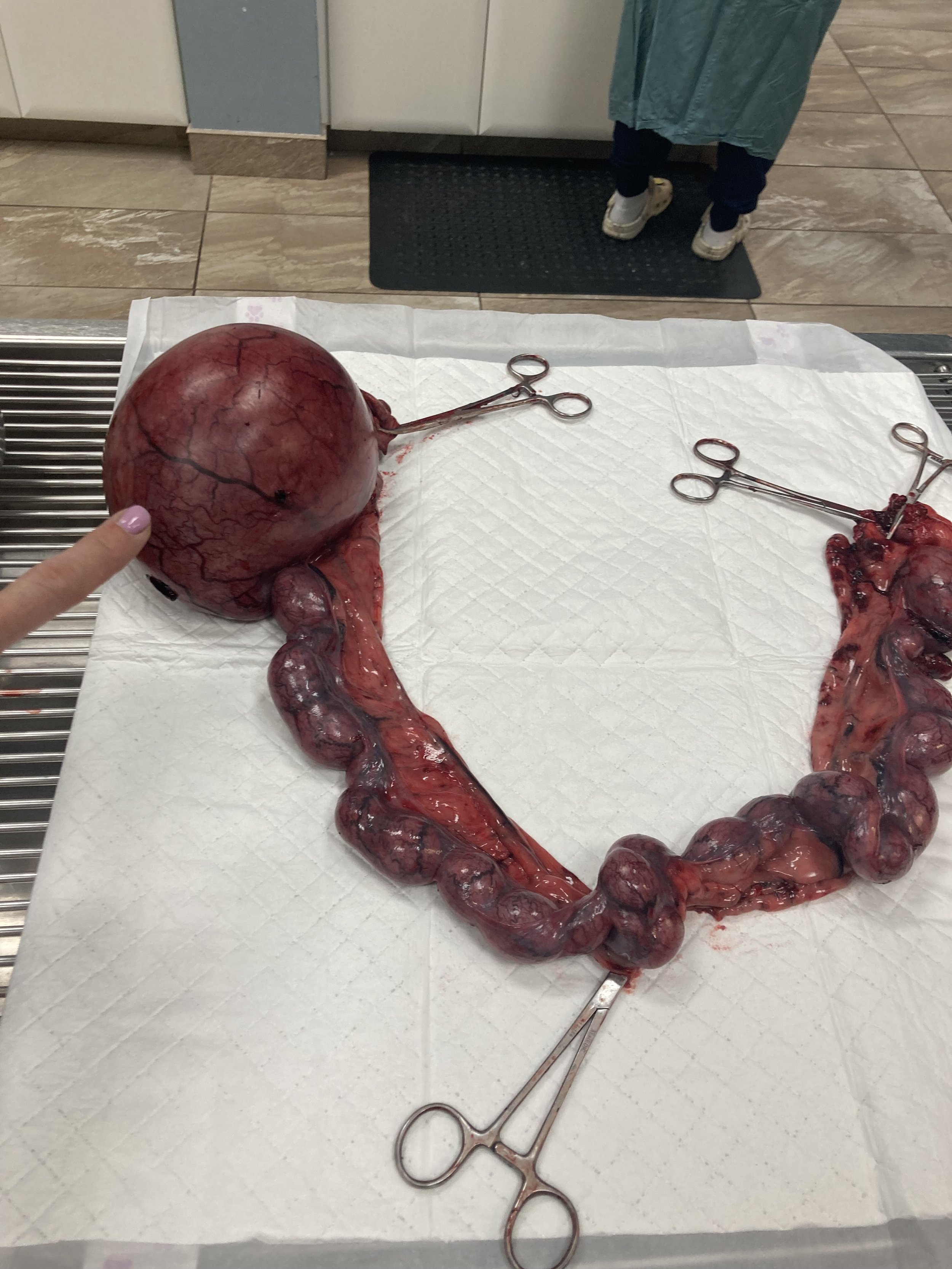 A realistic anatomical model of a human placenta and umbilical cord on a medical tray with surgical tools, possibly for educational purposes.