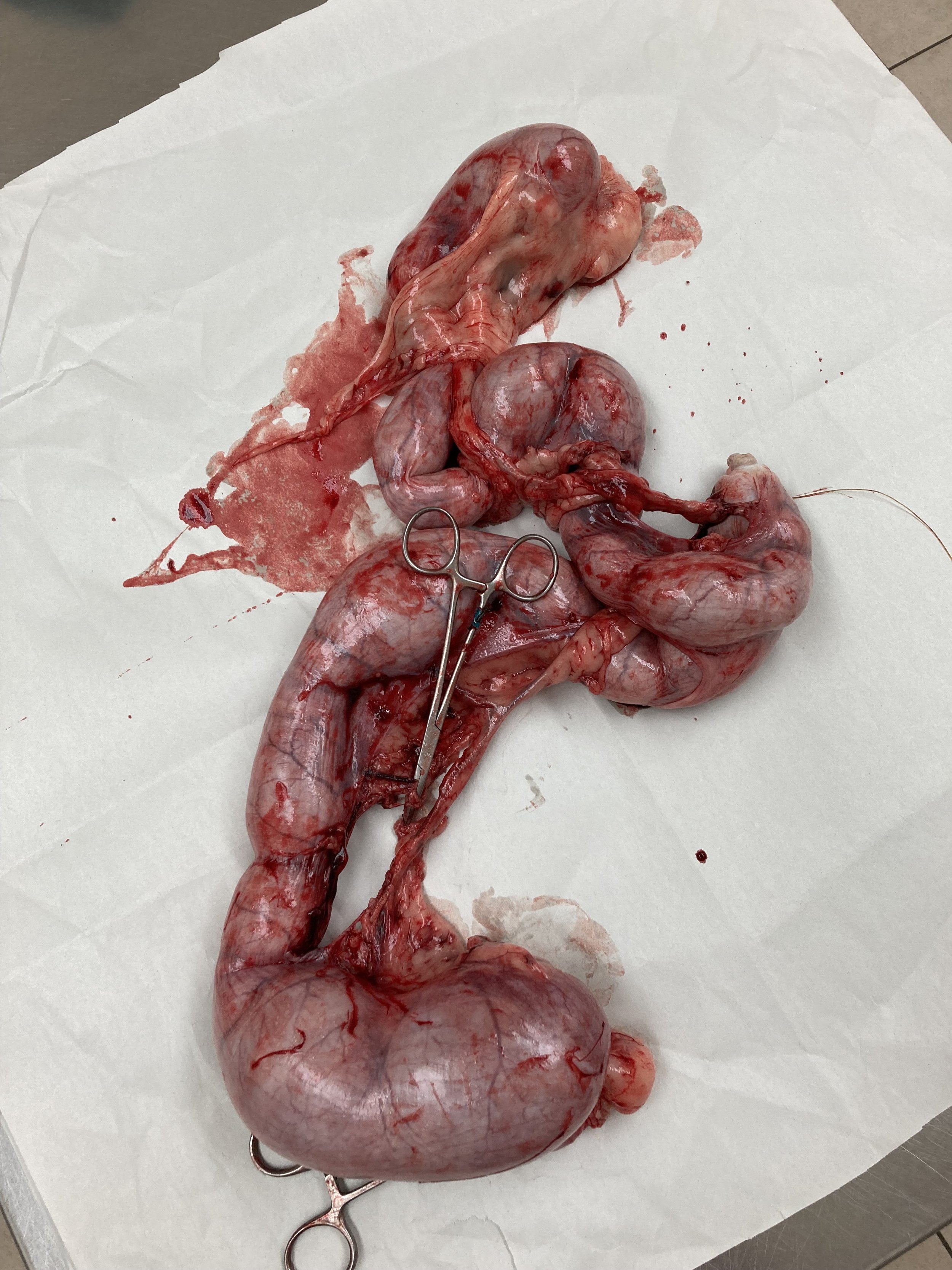 A collection of human internal organs, including intestines, laid out on a white sheet with surgical scissors in the middle.