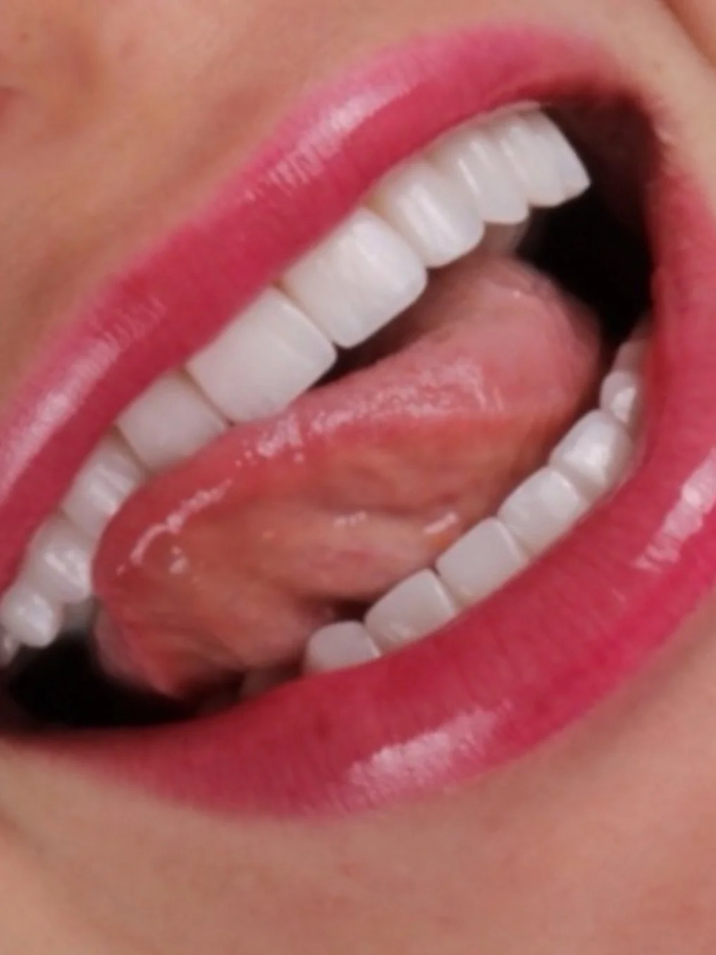 ✨Aesthetic dentistry, elevated. Full mouth rehab with veneers for a smile that&rsquo;s both natural and unforgettable. Based in #tucson.