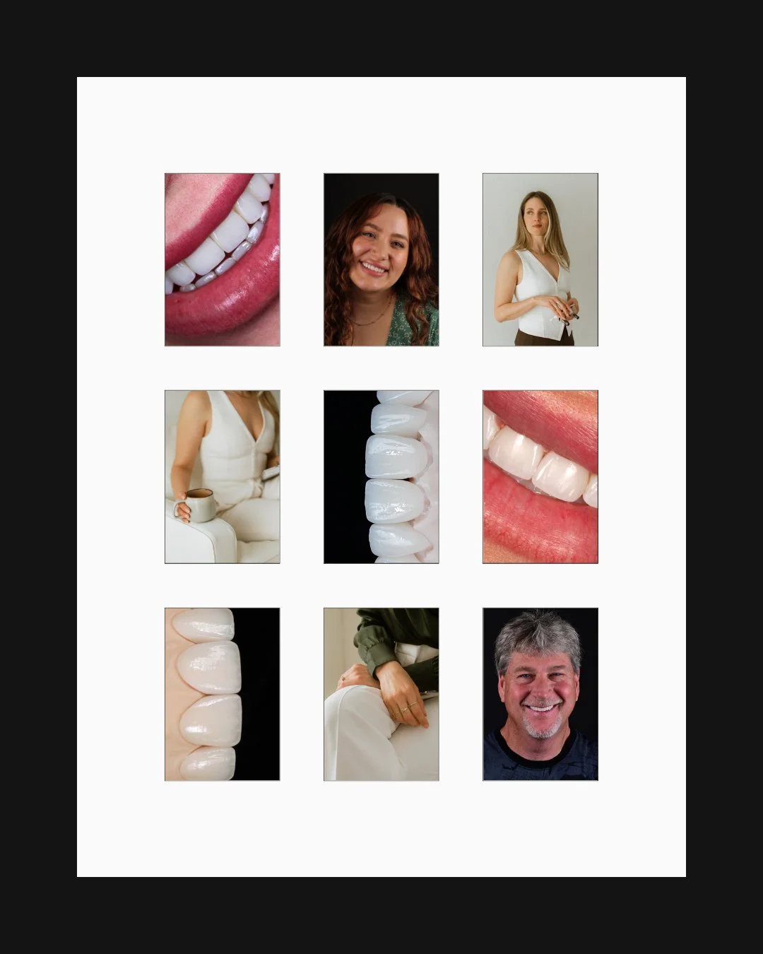 If you are new here, this page is centered on veneer design that feels natural, measured, and built around the person wearing it.⁠
⁠
That means we look beyond shade. We evaluate proportion, bite support, lip dynamics, enamel preservation, and how the