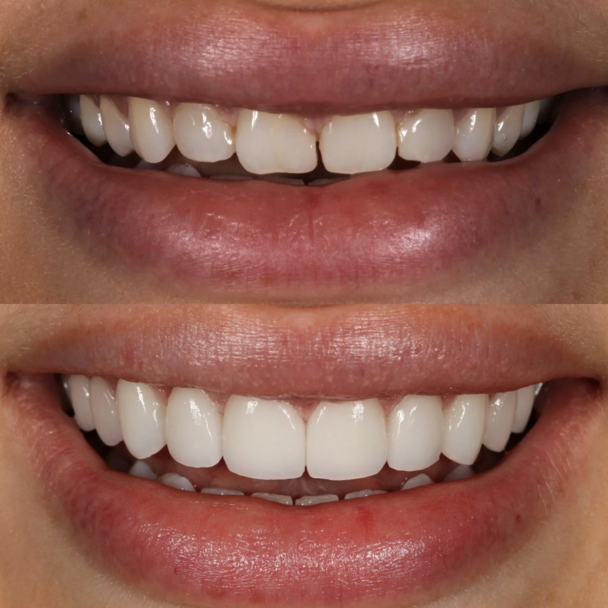 Smile Makeover Tucson
