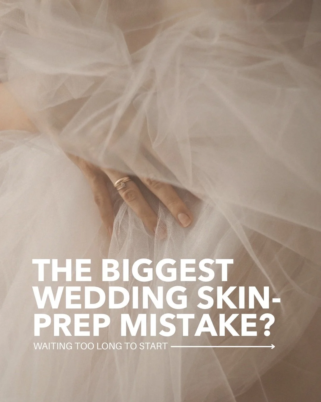 Everyone wants the wedding glow&hellip;
but no one talks about the timeline it actually takes.

The biggest mistake we see? Waiting until the last minute.

Real skin, body, and wellness results aren&rsquo;t rushed&mdash;they&rsquo;re built.
The earli