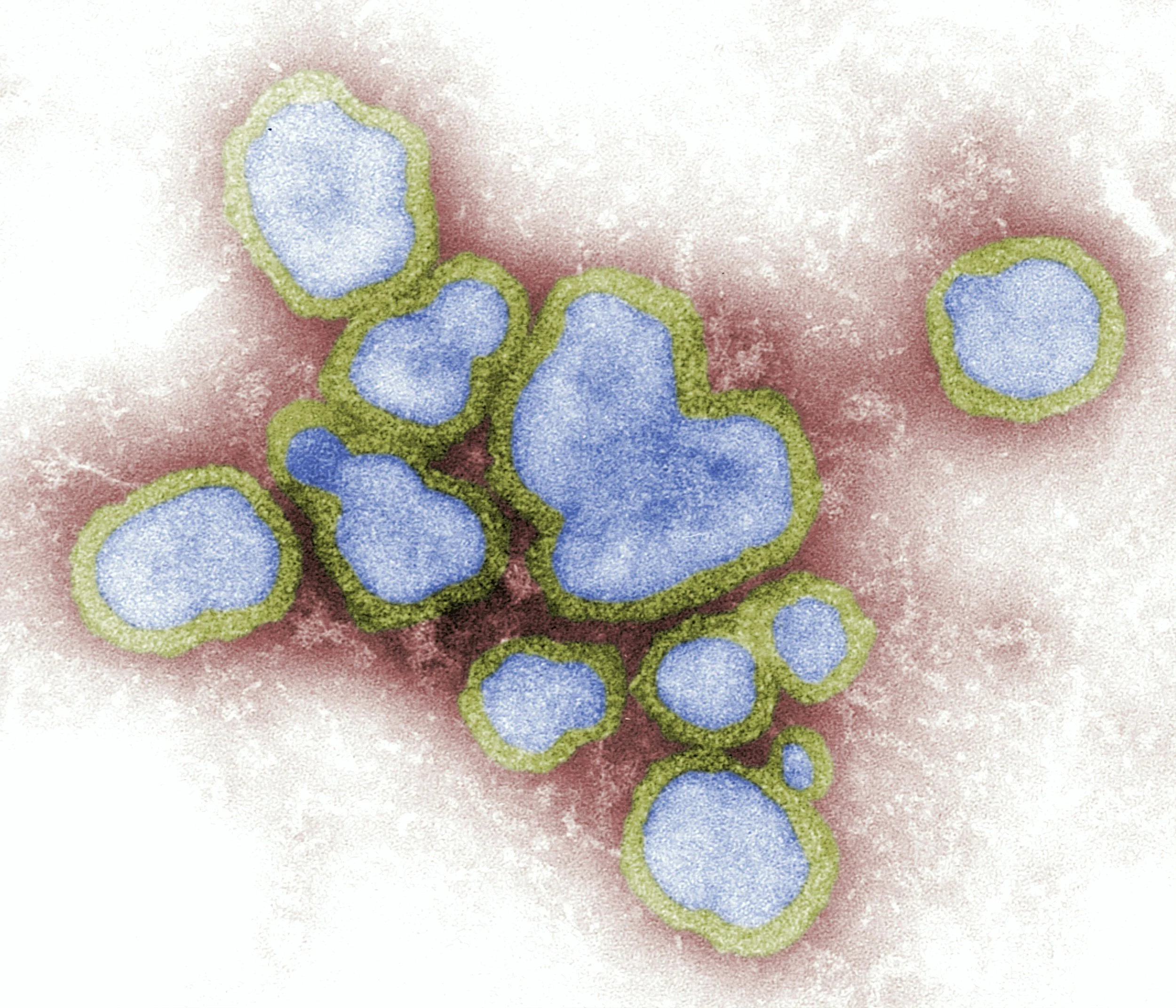 Colored illustration of a virus with blue protein cells surrounded by green borders.