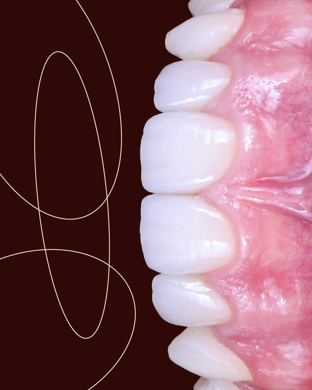 Close-up of a person's upper front teeth and gums with a dark background and abstract line art.