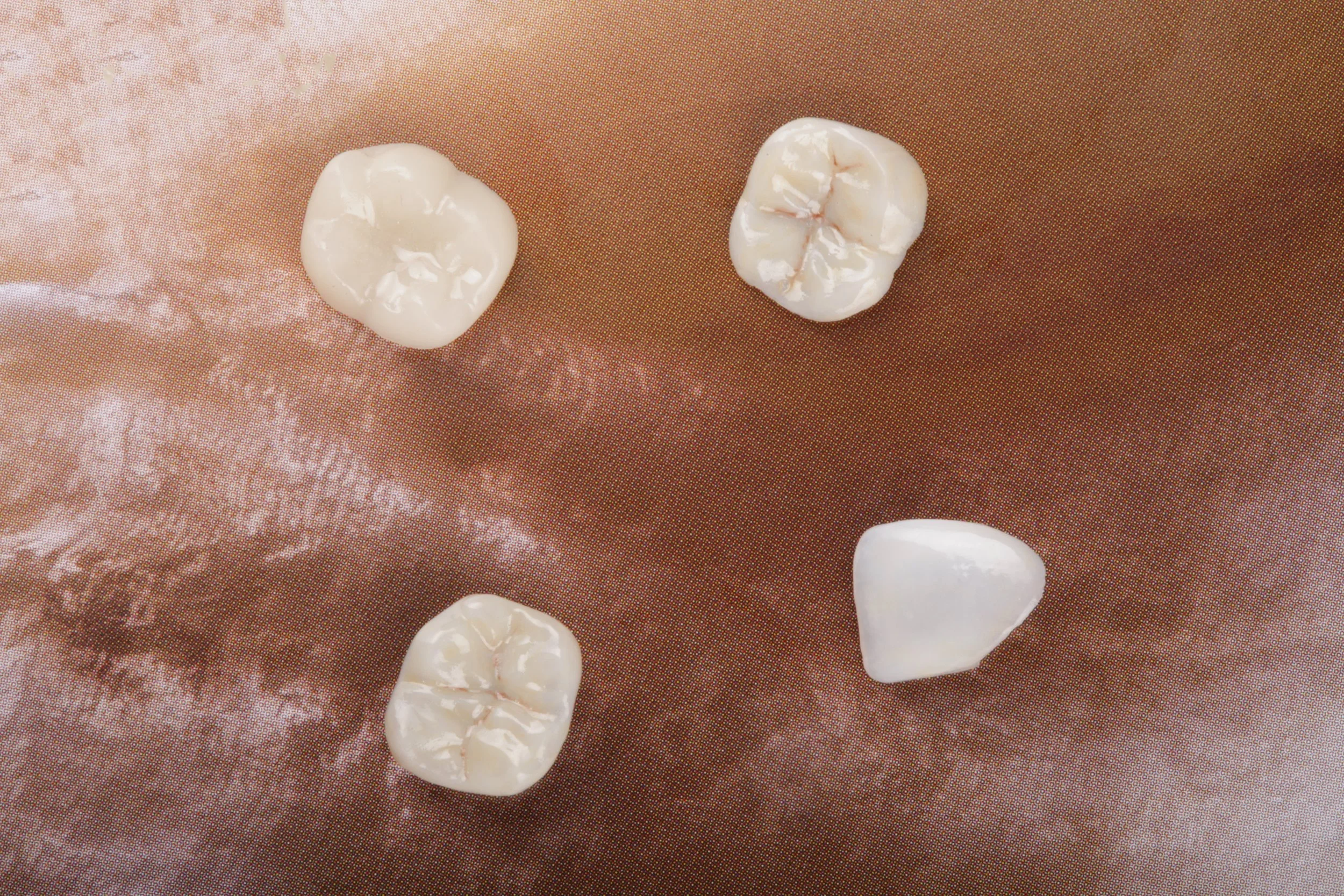 Four dental crowns or caps placed on a brown cloth surface.