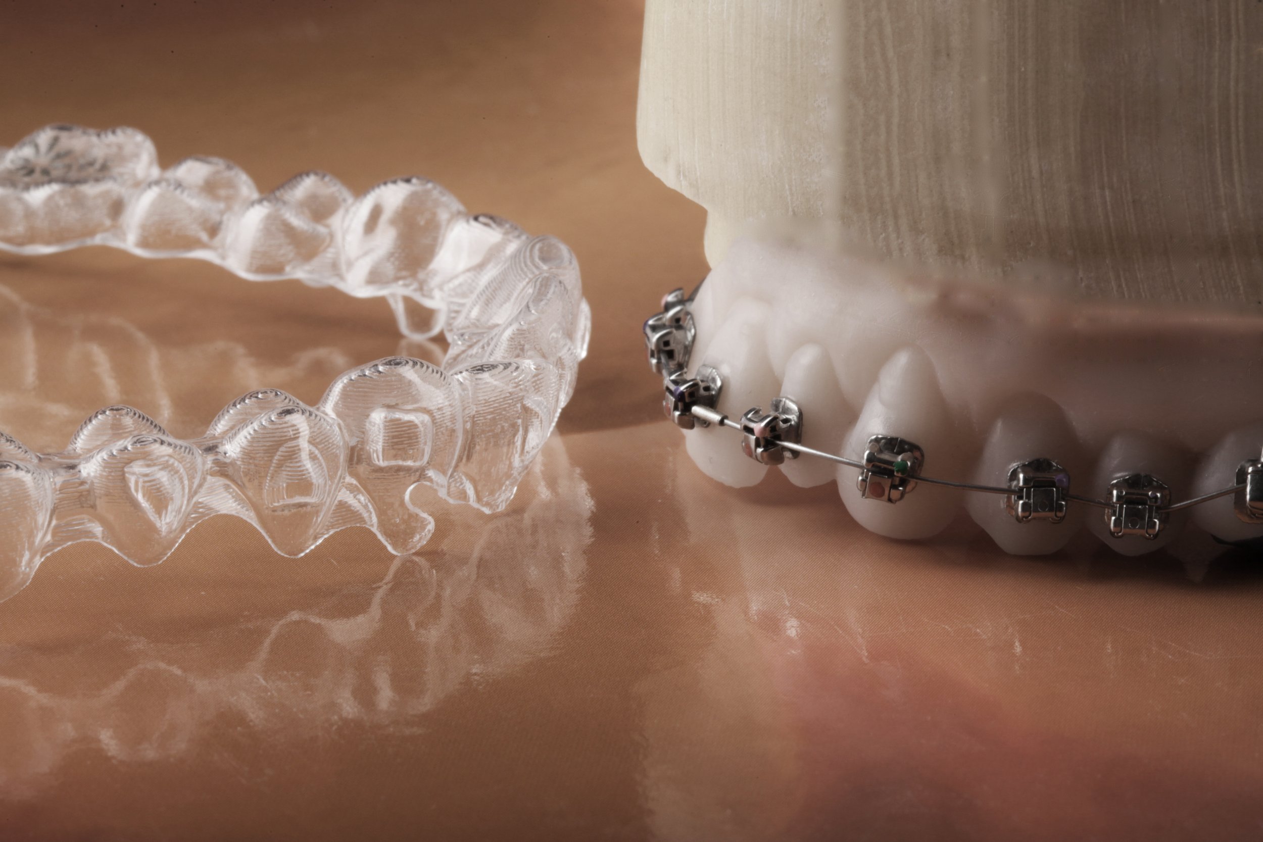 A transparent dental retainer and a model of teeth with braces on a reflective surface.