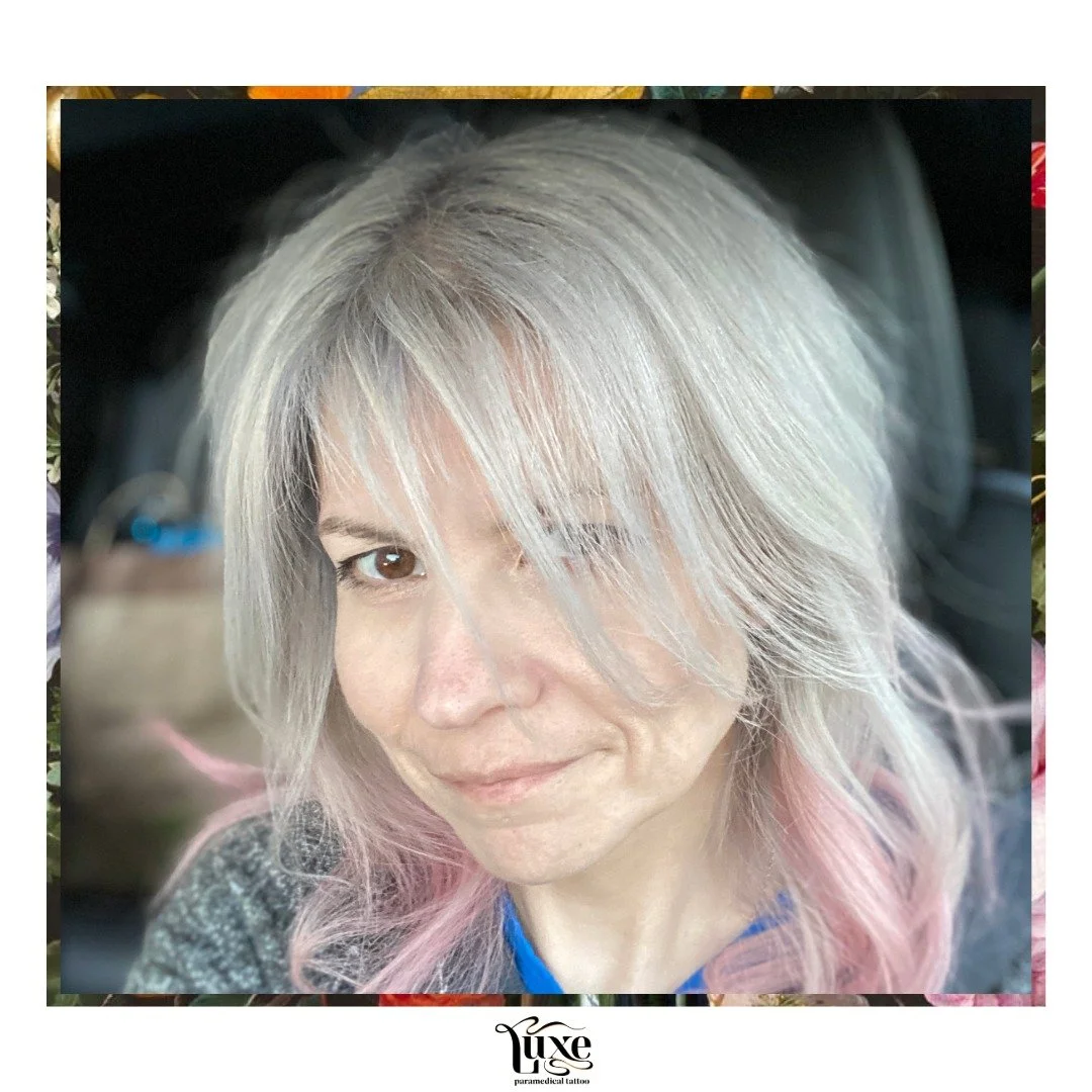 Confidence doesn&rsquo;t always come from the gym&mdash;it can come from your skin healing, too.

This client takes amazing care of herself, but no matter how much she exercised, the crepey texture and loose skin on her arms never improved. Surgery w