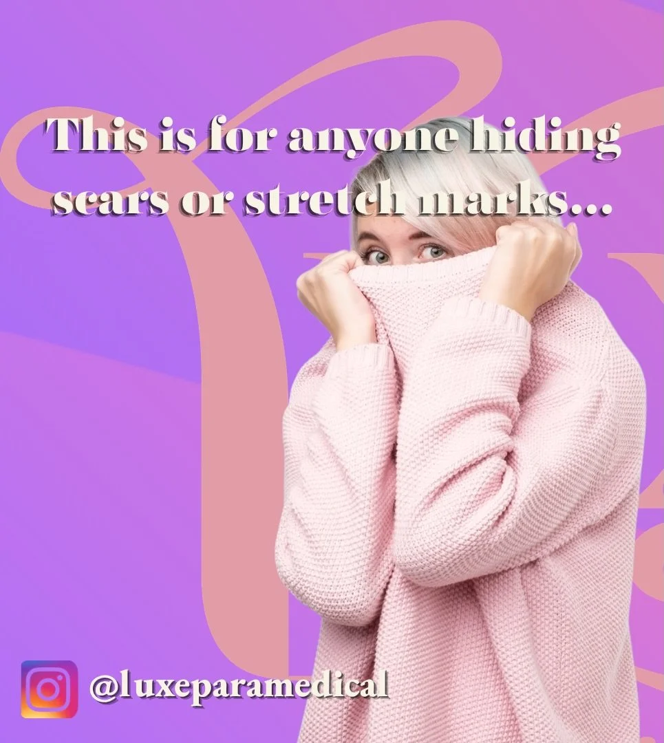 Inkless scar camouflage = no pigment, just skin stimulation to improve texture + tone
✔ Great for certain scars &amp; stretch marks ✔ Builds gradually over sessions ✔ Natural-looking results
Not sure if you&rsquo;re a candidate? 💬 DM &ldquo;INKLESS&