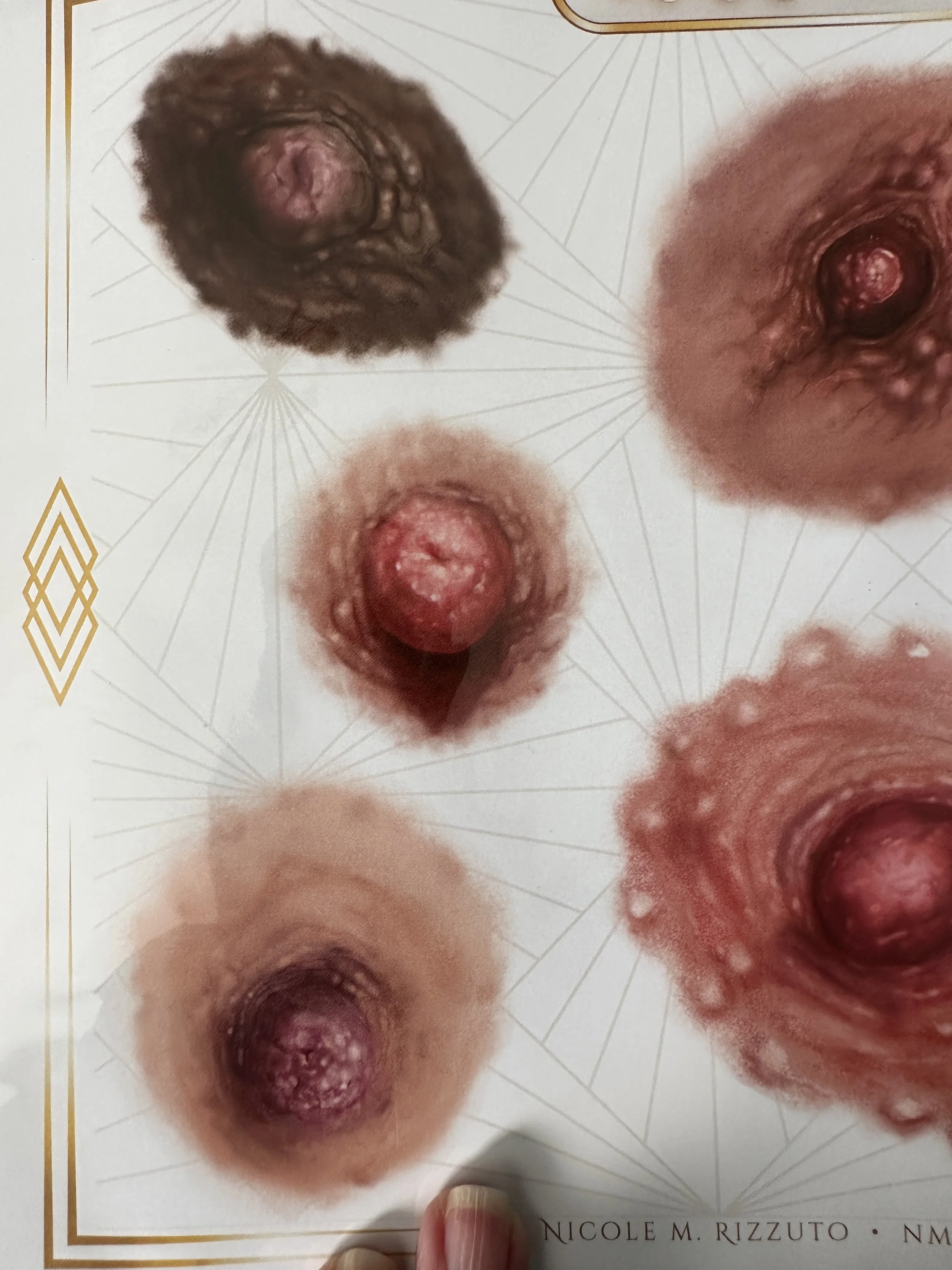 3D Areola Restoration Studies