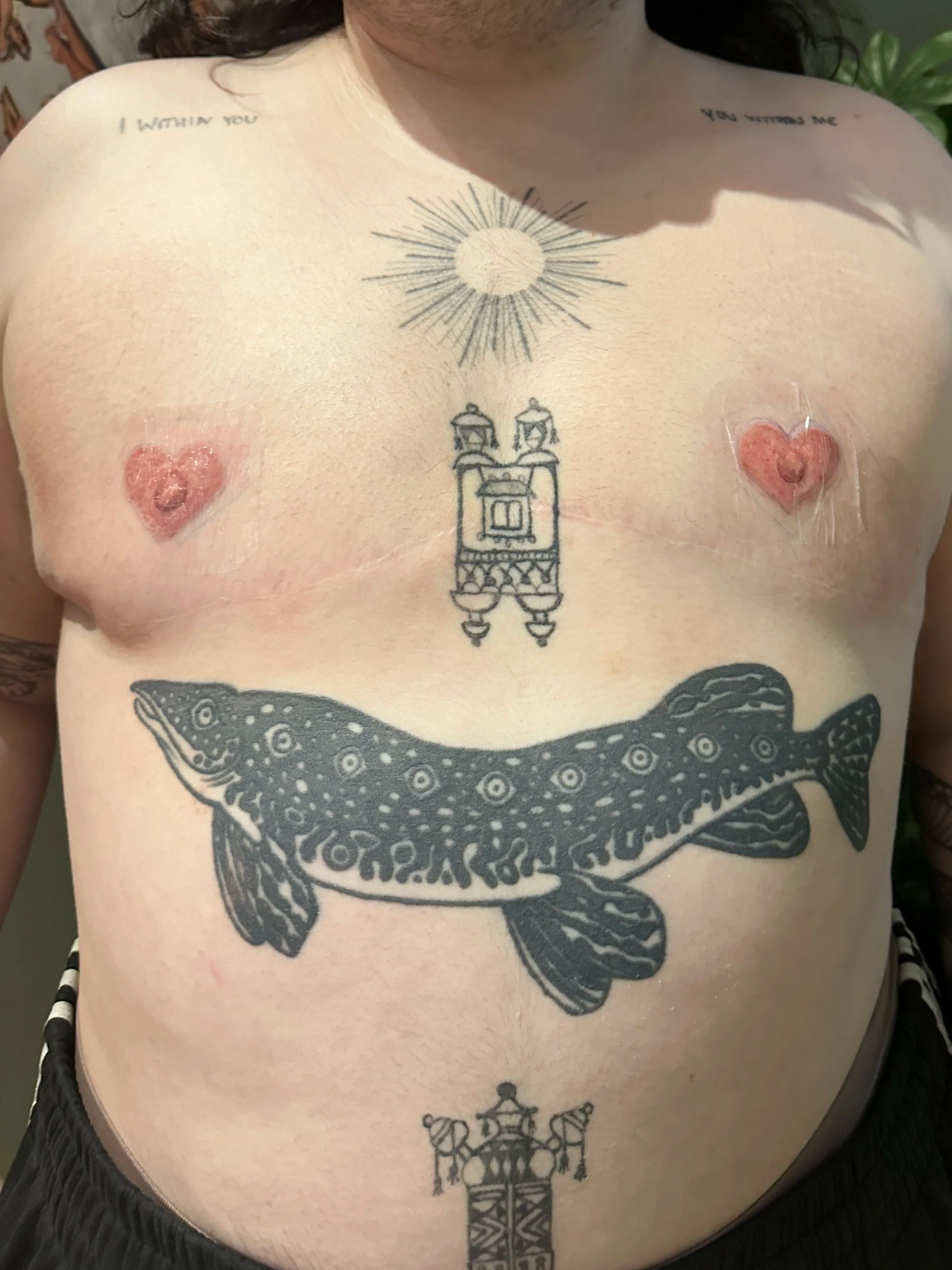 Gender Affirming Care