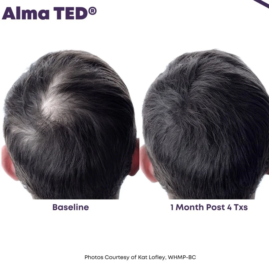 Alma_Ted_BA_K.Lofley_Q1-24_1326348962_Canva.jpg