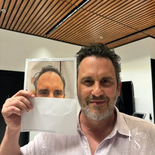 After 3 TED with TED Proprietary Serum