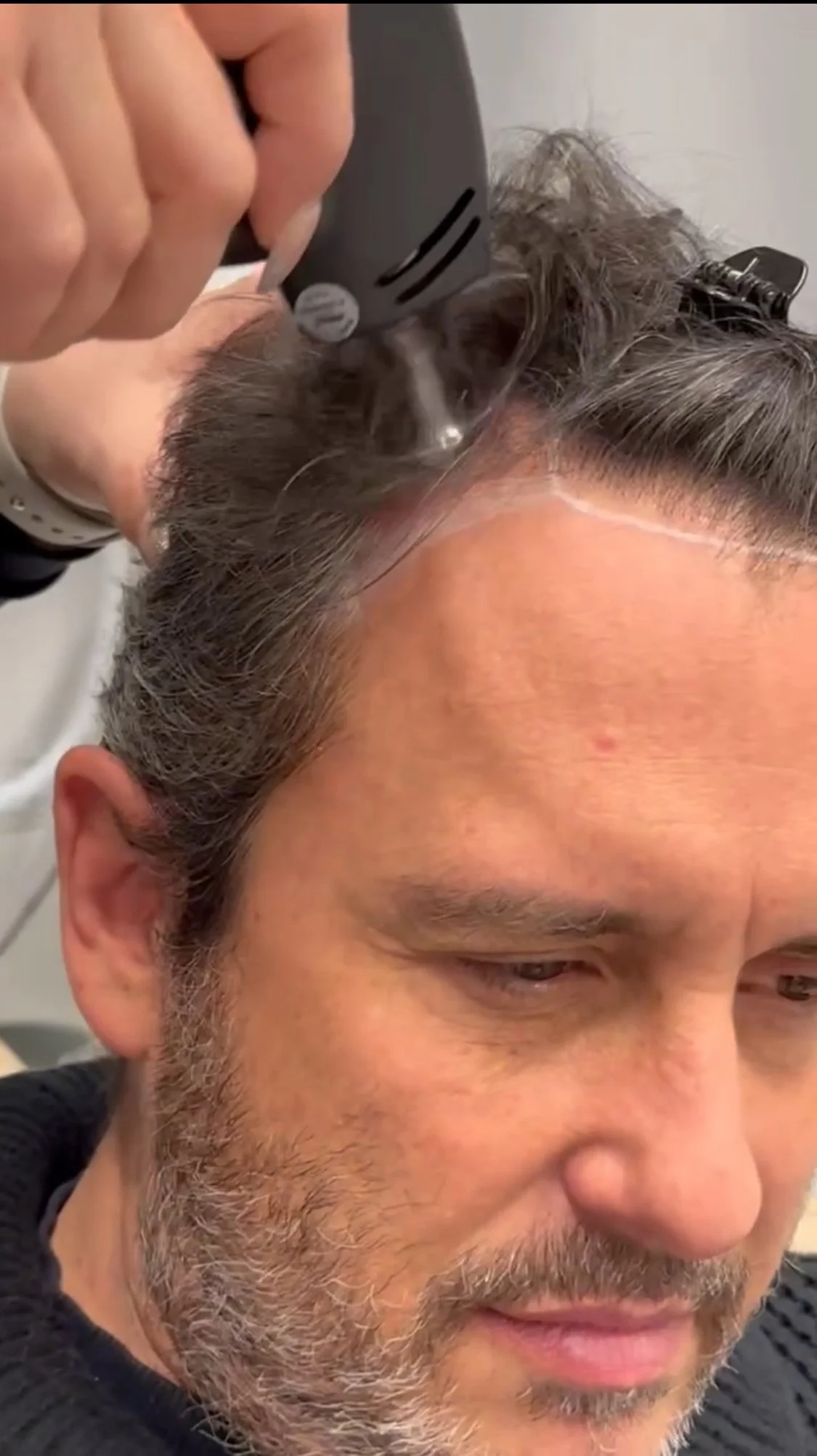 Getting the TED, completely painless