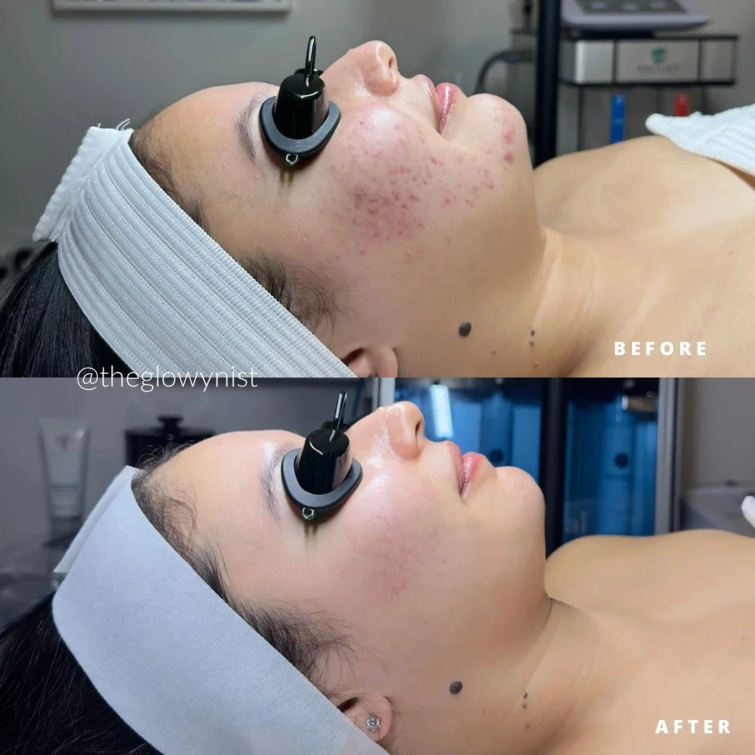 Can we please talk about this GLOW UP? ✨ These pictures are exactly 365 days apart 🤩

I really want to give this client most of the credit &ndash; she not only showed up with the most positive attitude and consistency, but she was also brave enough 
