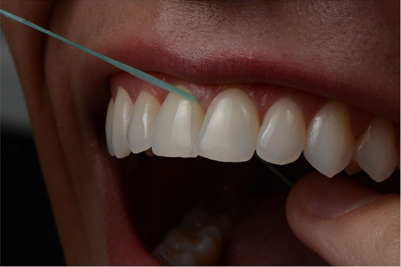 Periodontia em Alphaville