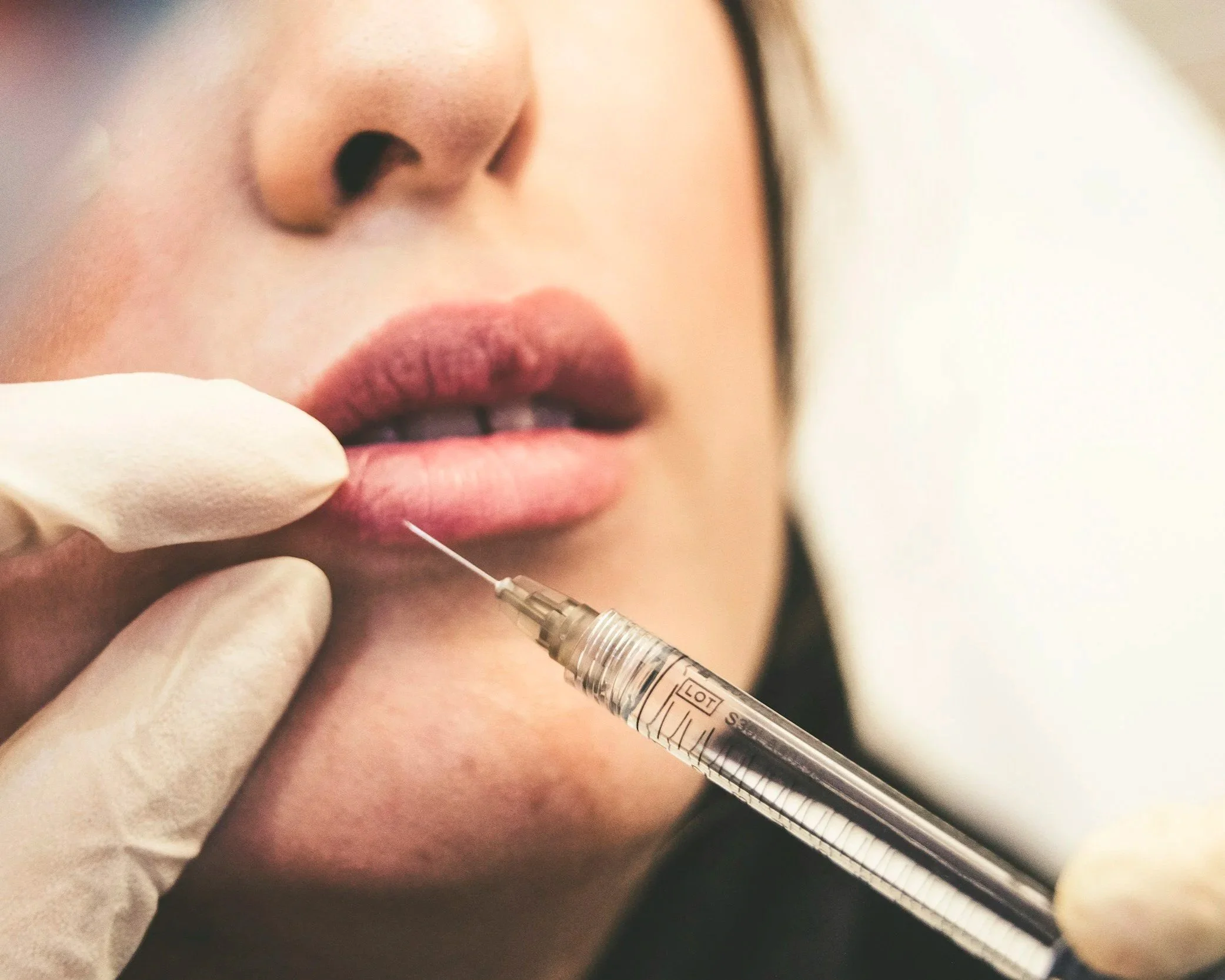 Harmonização Orofacial no Dentista