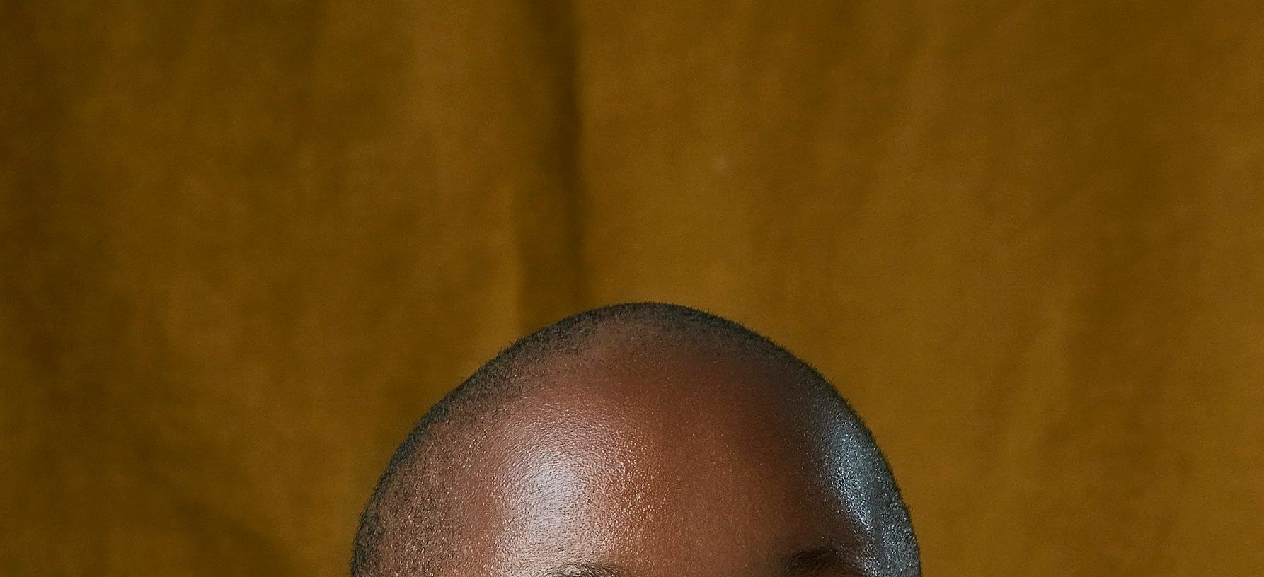 Blog 3 — Alopecia in UK Black Women - Systemic Care for Mental Health ...