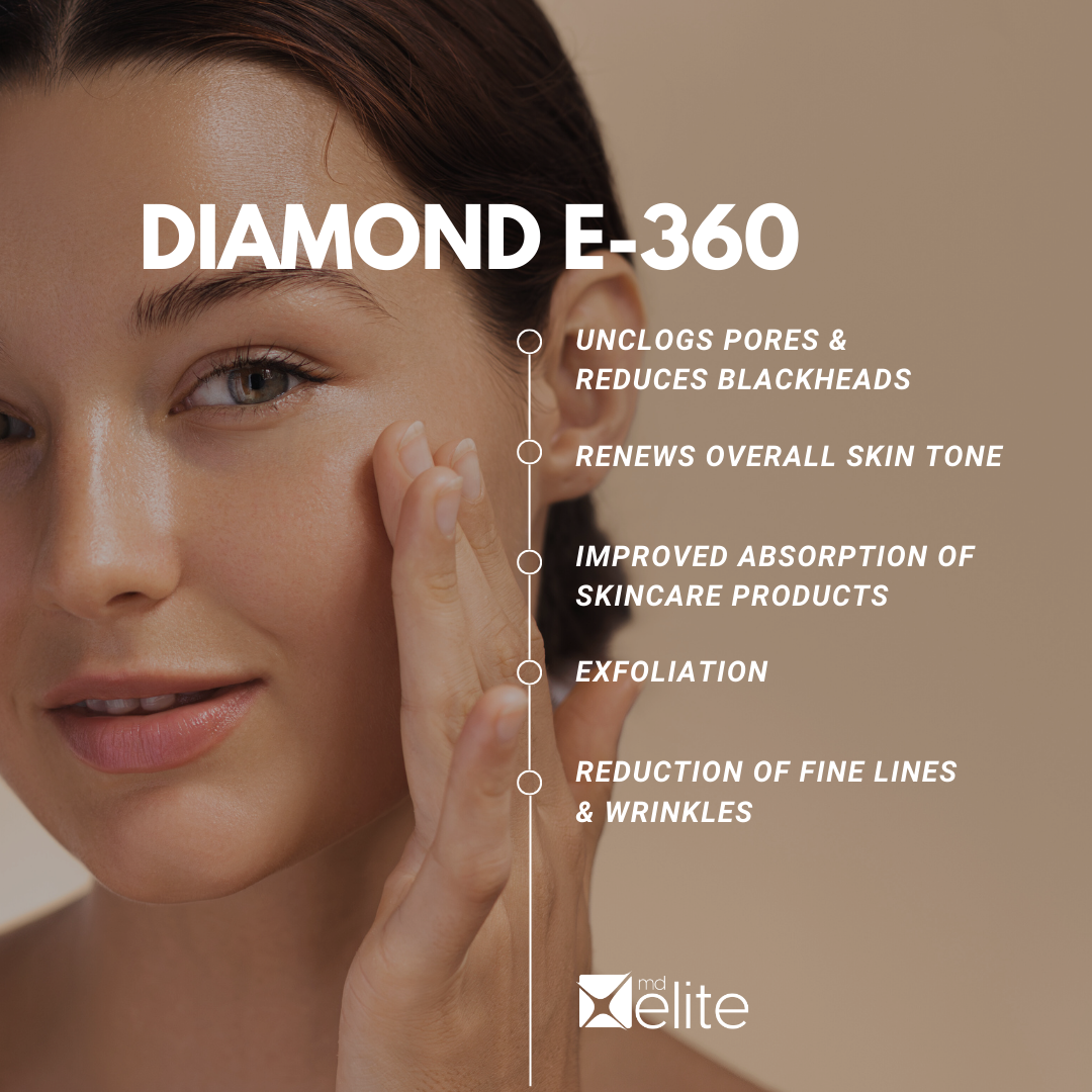 A woman touching her face with text overlay promoting the Diamond E-360 skincare treatment, highlighting benefits such as unclogging pores, reducing blackheads, renewing skin tone, improving absorption, exfoliation, and reducing fine lines and wrinkles.