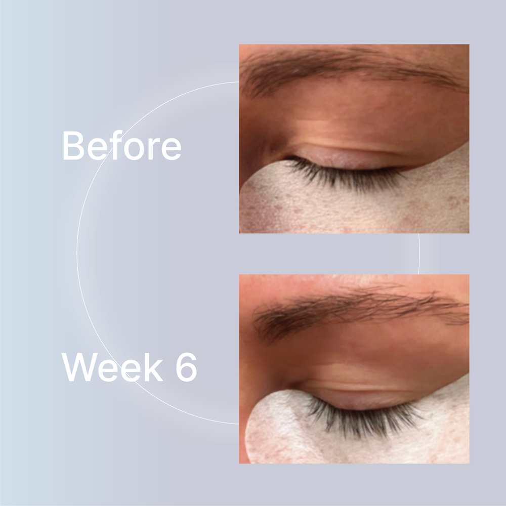 Lash+++Brow+-+Before+&+After+1.png.webp