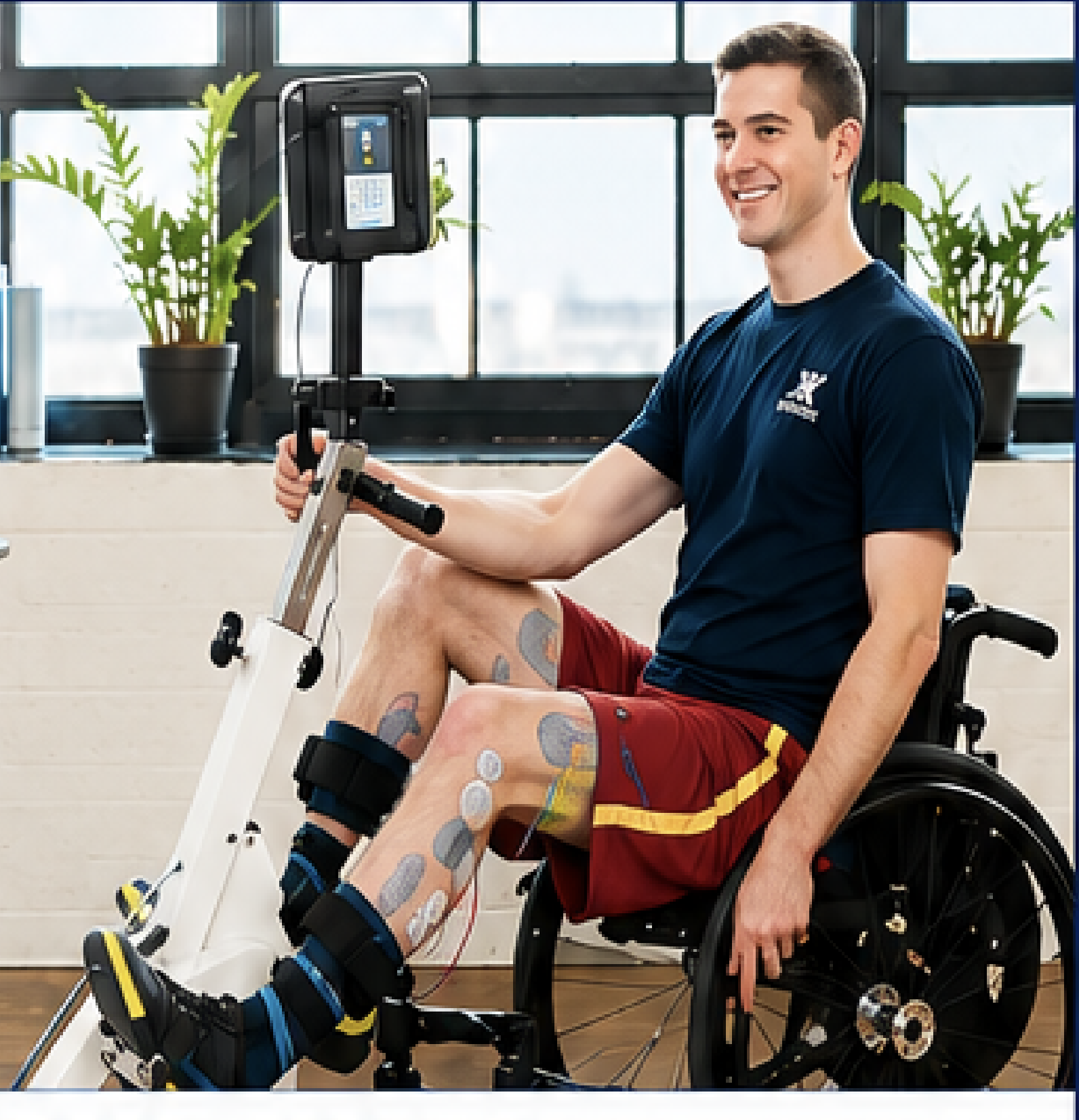 Functional Electrical Stimulation Cycling: Advancing Recovery Through Technology