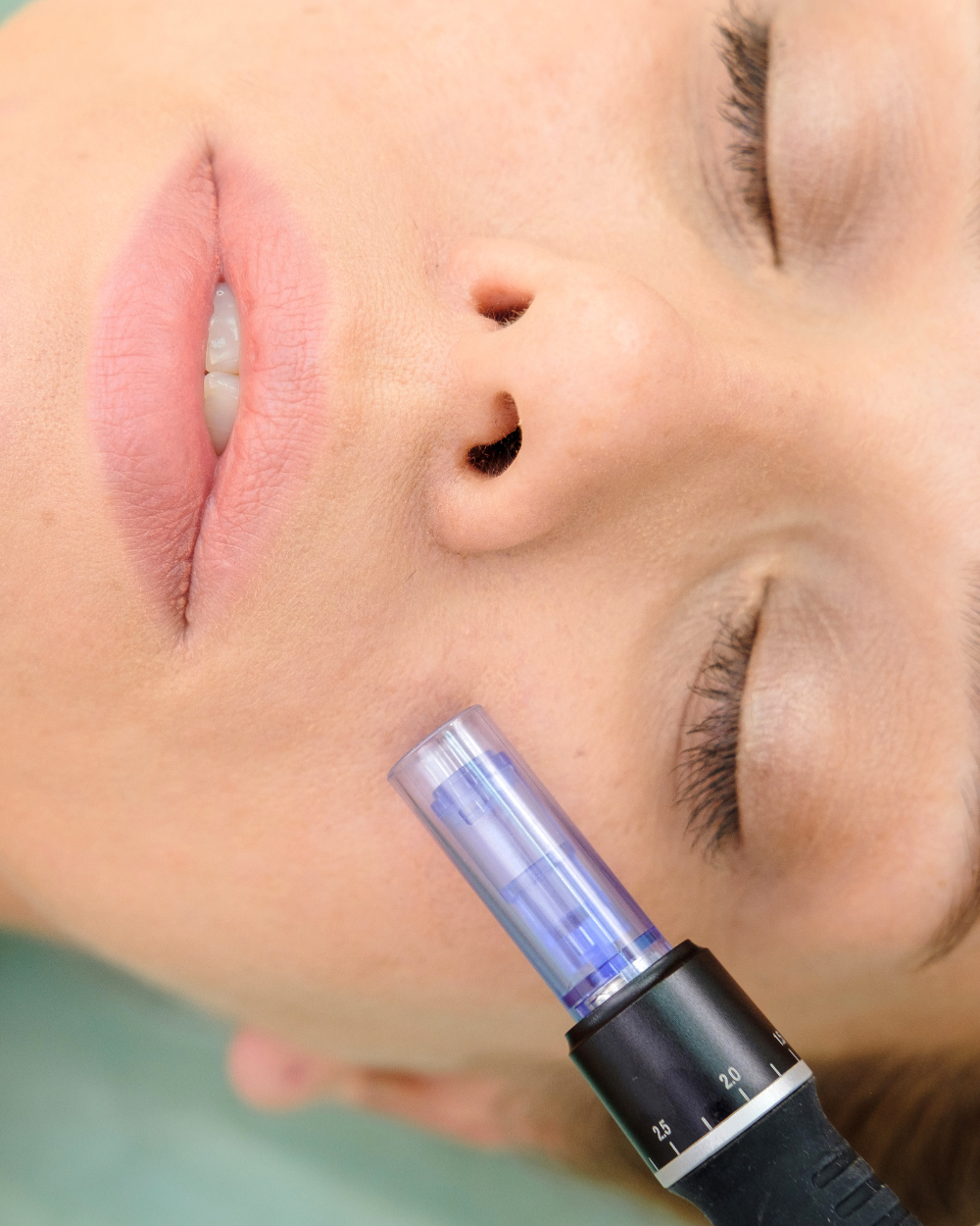 microneedling pen on face
