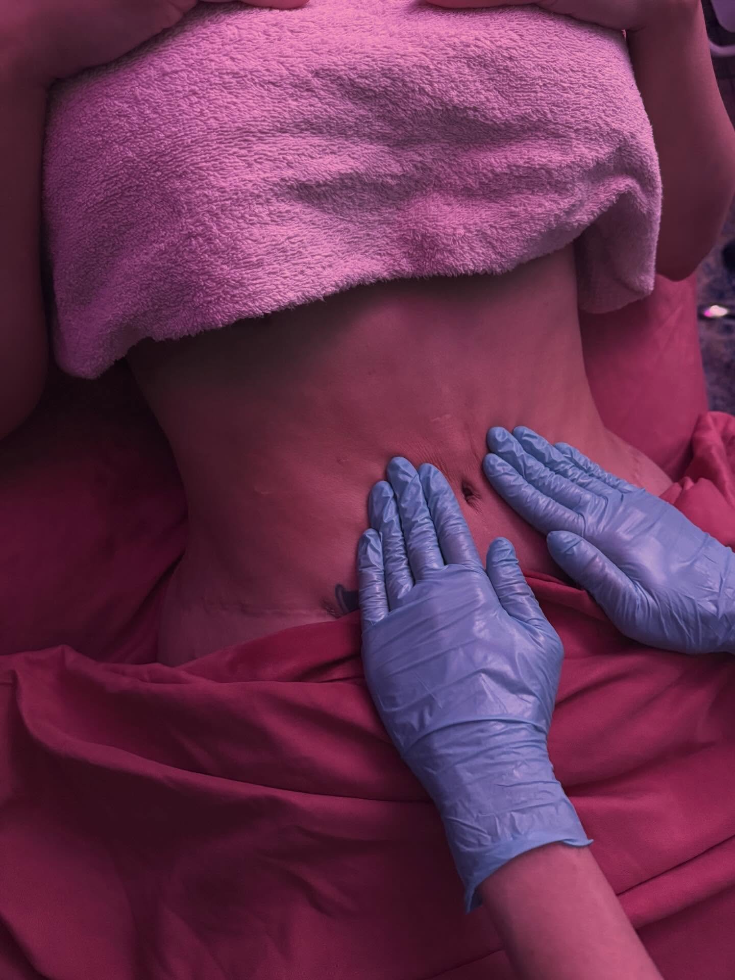 ✨ Post-Op Lymphatic Drainage Massage: Gentle, Safe, and Evidence-Informed Care ✨

After cosmetic surgery, patients often look for reduced swelling, comfort, faster recovery, and peace of mind knowing their body is healing properly. Post-operative lym