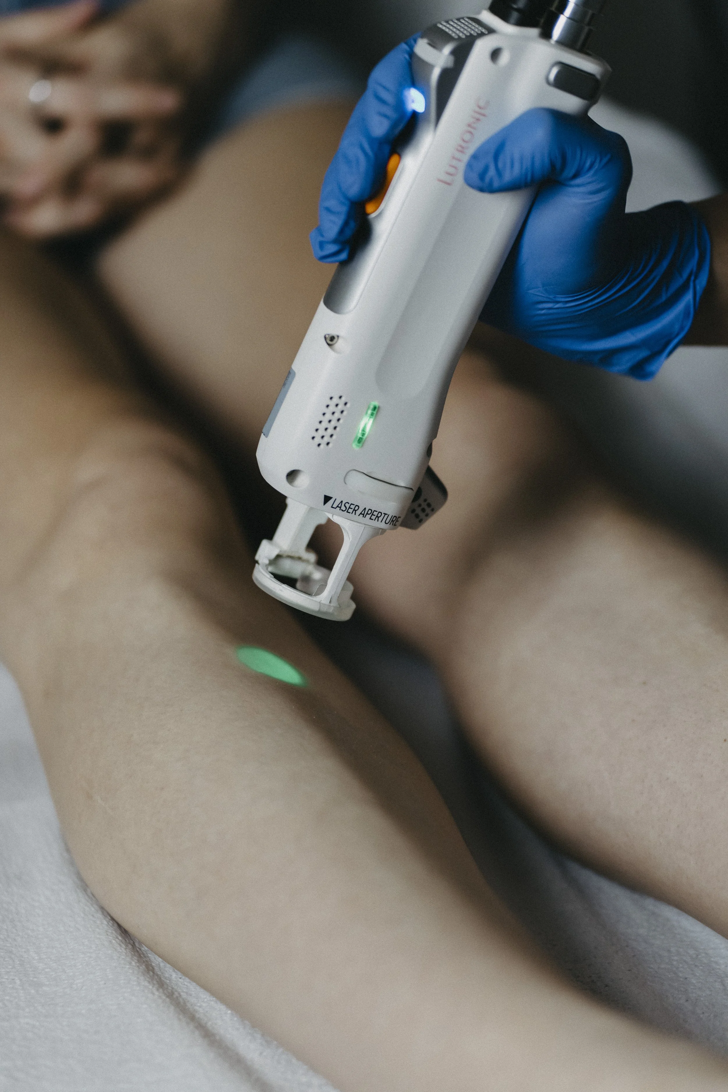 a woman getting laser hair removal at Belle Aesthetics, a med spa in Stewartstown PA